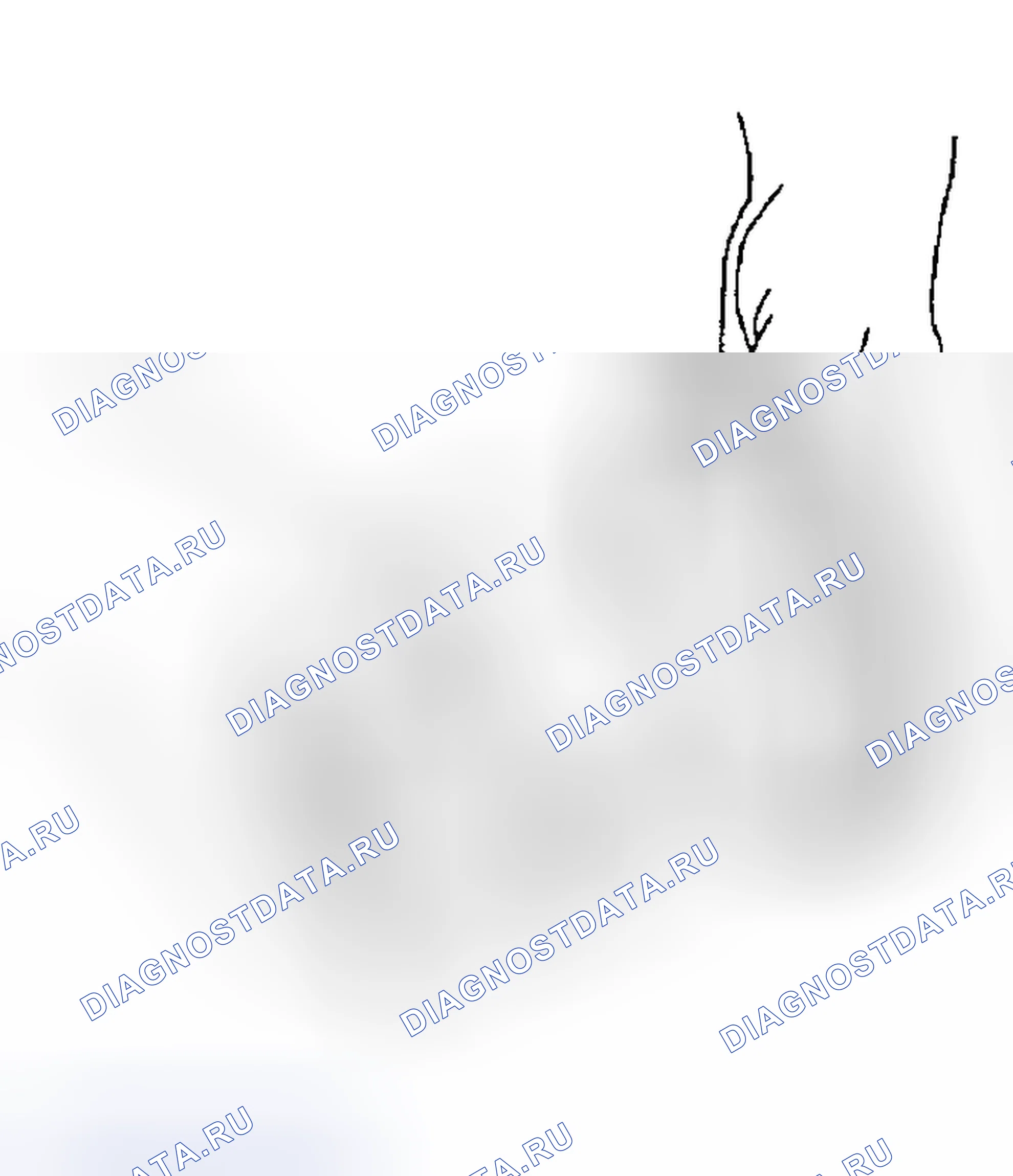 Рис. 96. Subaru Legacy BE/BH/BT