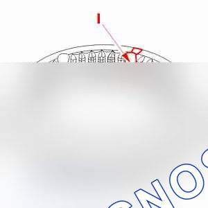 Разборка - сборка: синхронизатор — b2ck11gc. Peugeot 607 I