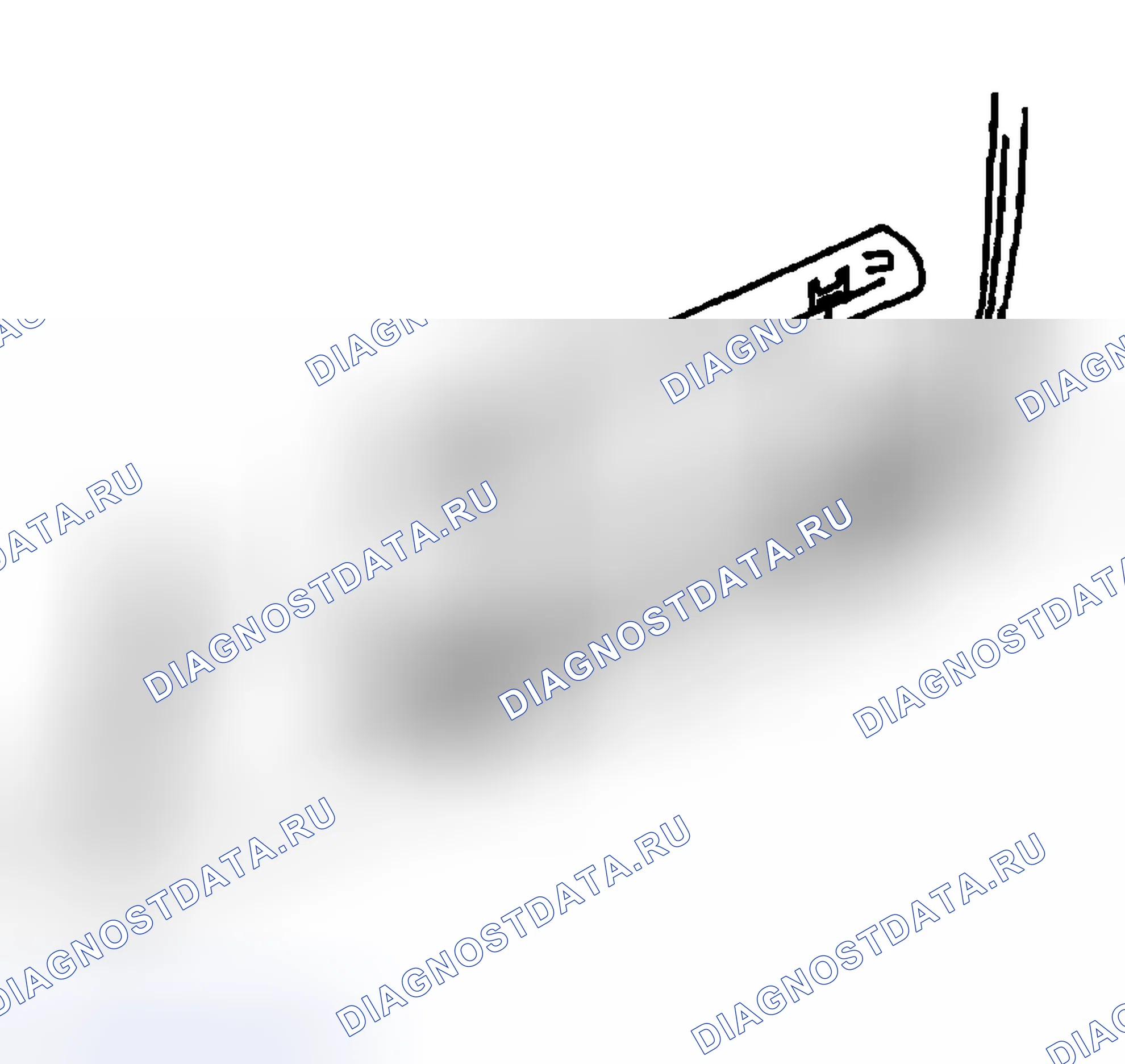 Рис. 4: Процедура установки. Buick Regal IV