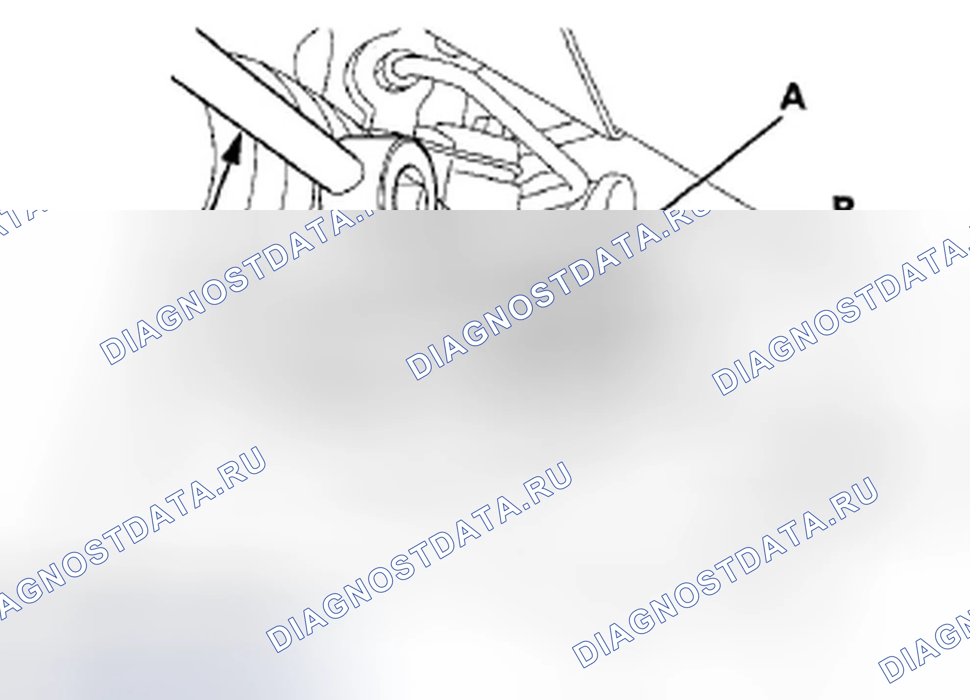 Рис. 4: Регулировка направляющей штатива. Acura ZDX I