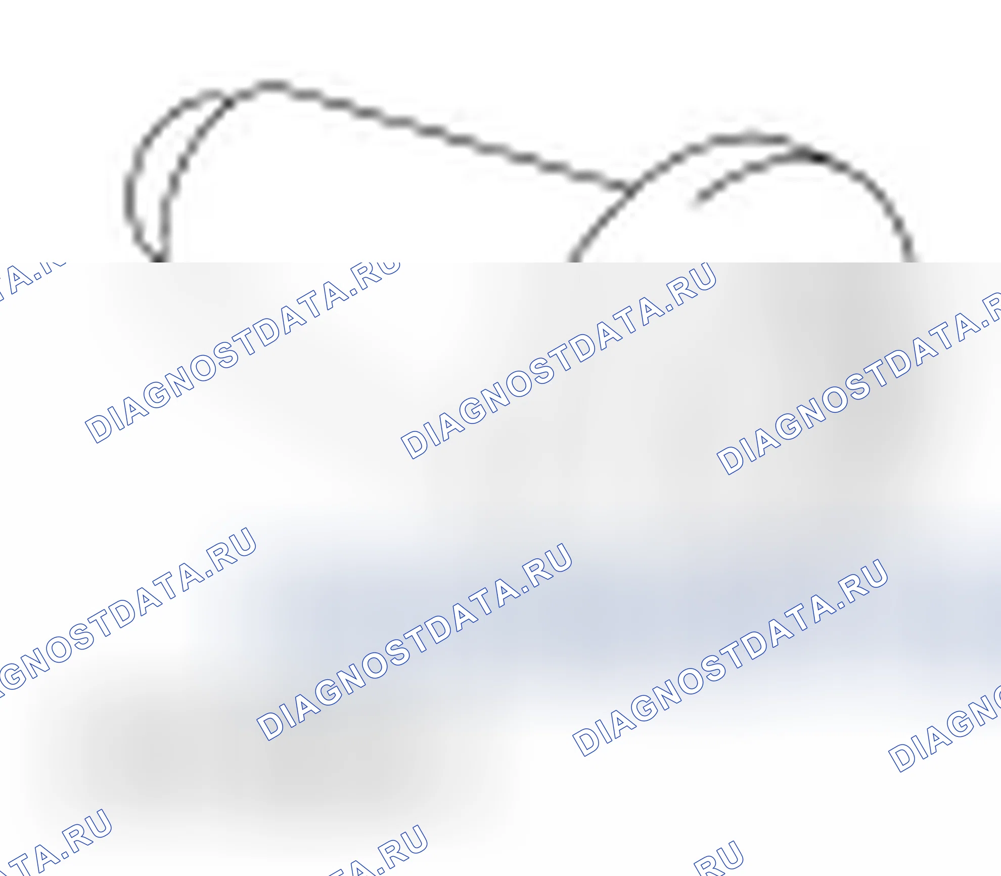 Рис. 290: Дифференциальное кольцо и шестерня. Ford Mustang V