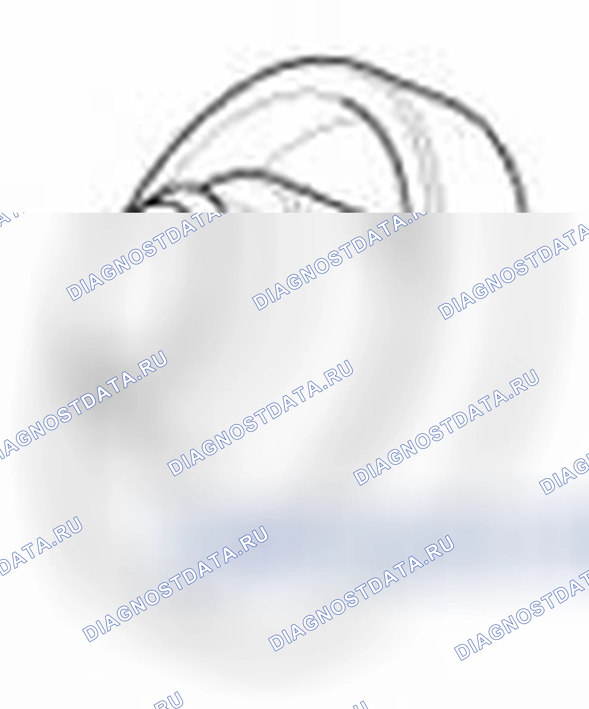 Рис. 48. Hyundai Veloster I