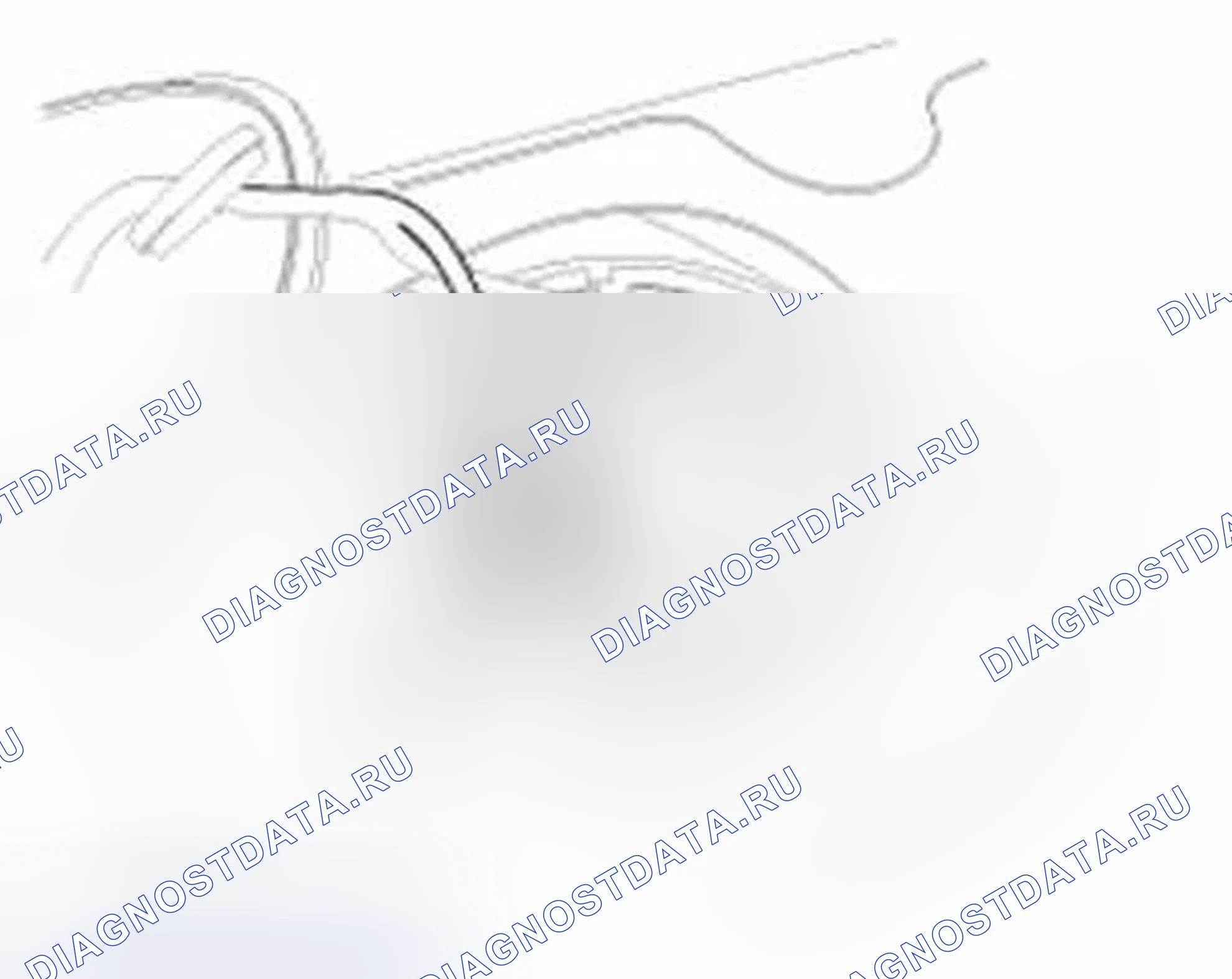 Рис. 38. Hyundai Elantra V