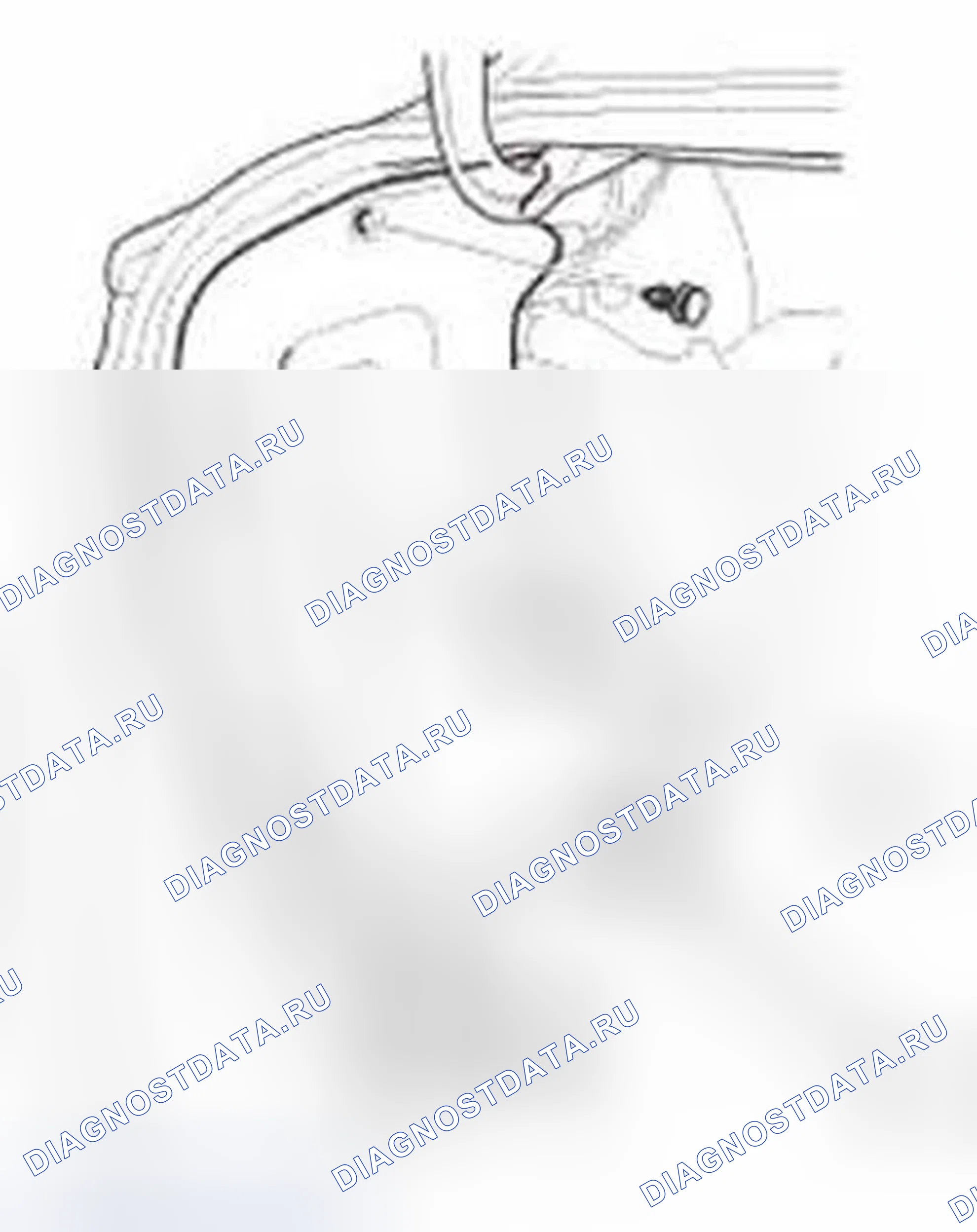 Рис. 178: Установка. Honda Civic IX