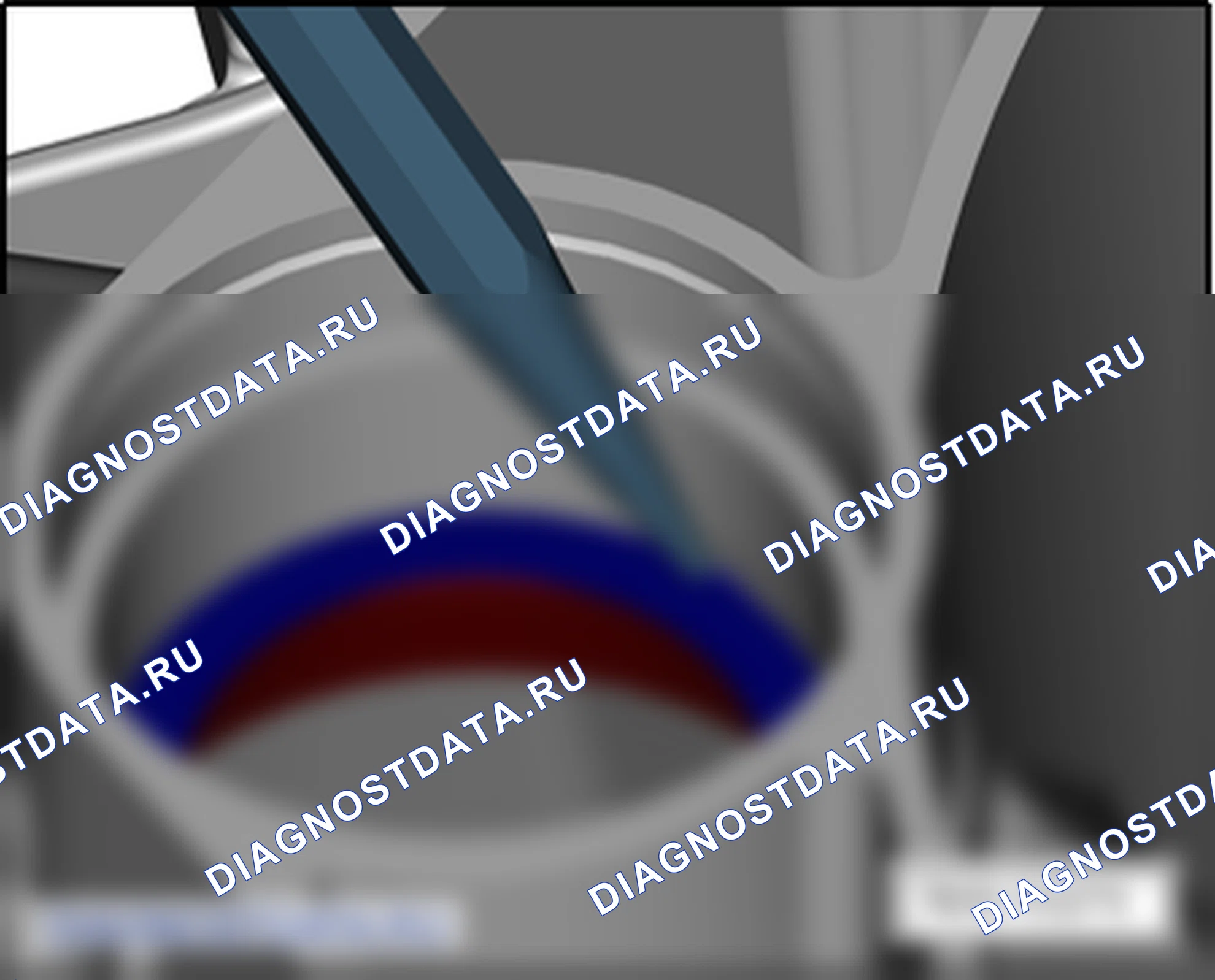 Как отремонтировать разборка и сборка картера сцепления. SEAT Altea I