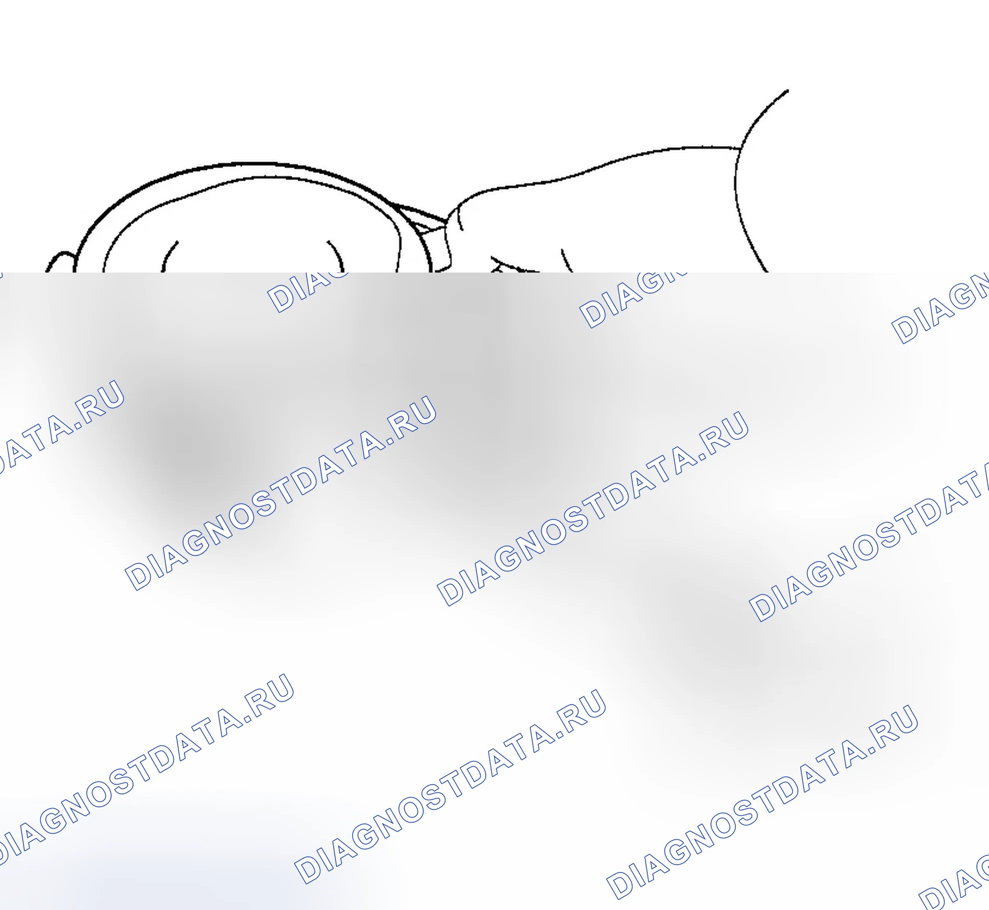 Рис. 162. Hyundai Accent II