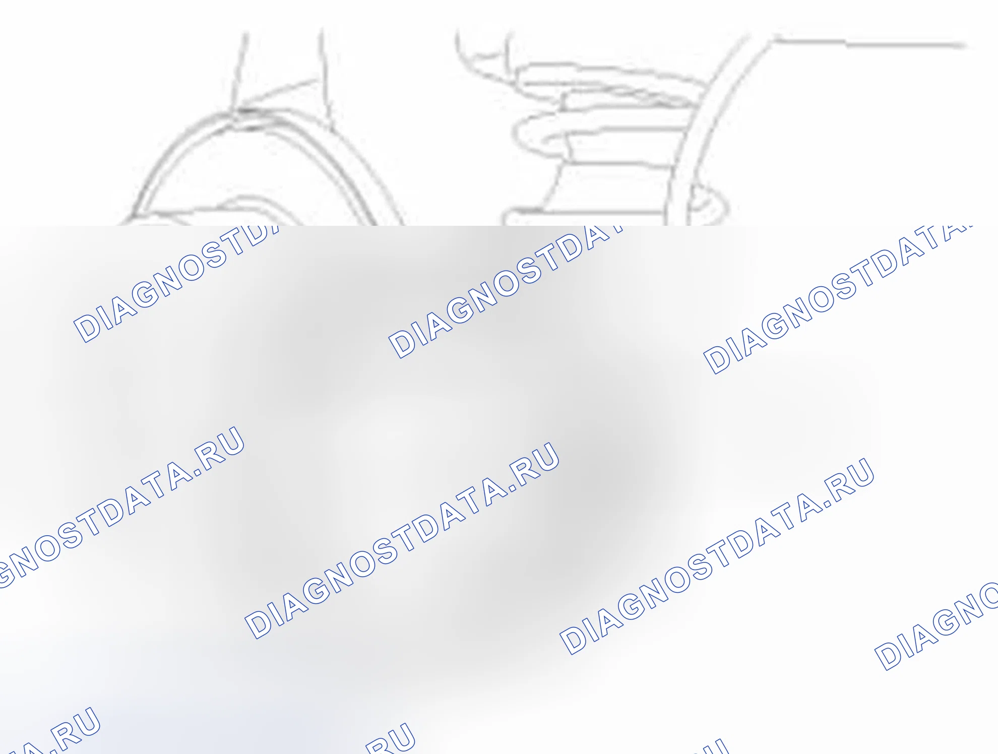Рис. 45. Hyundai Elantra V