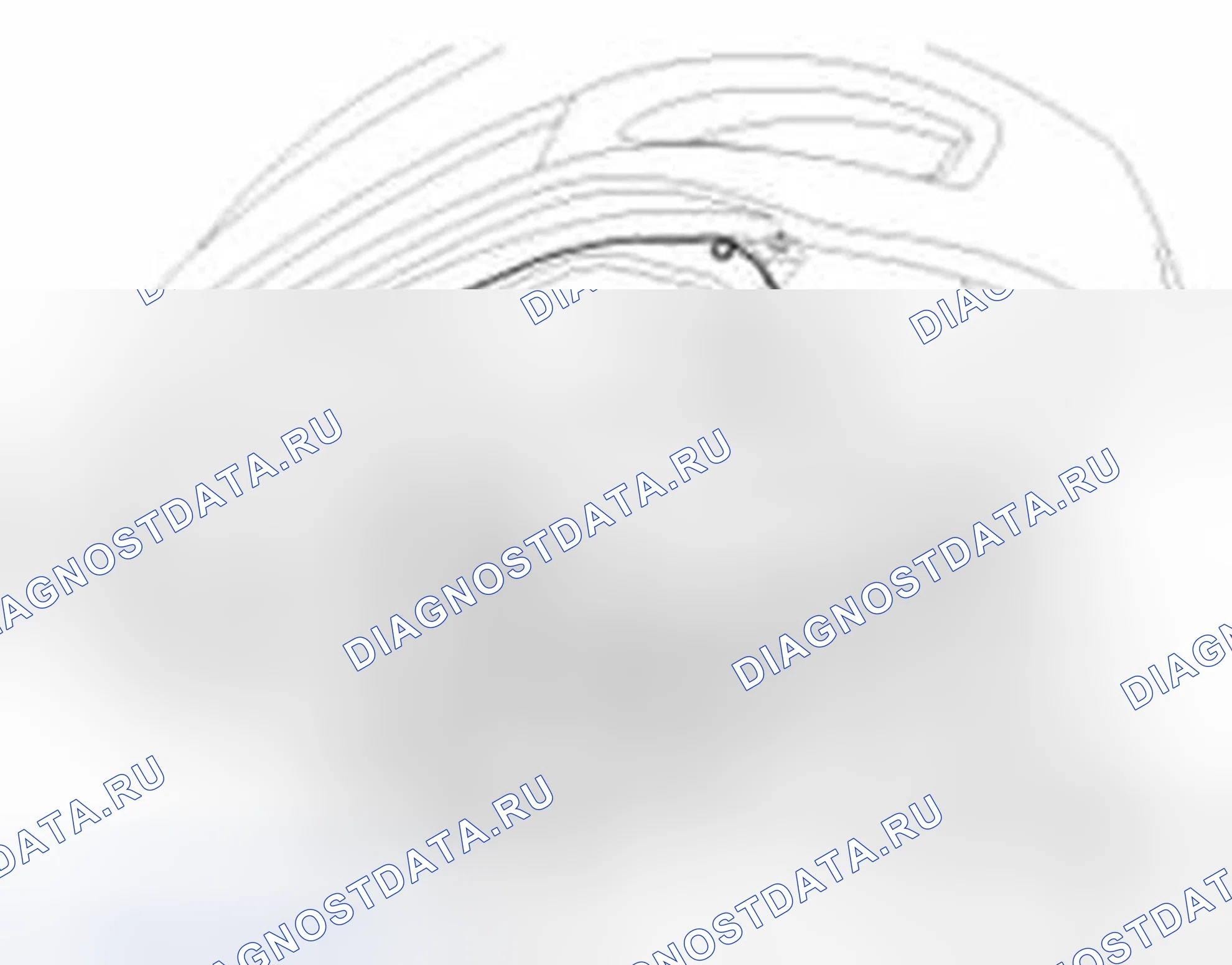 Рис. 43: Демонтаж. Hyundai Sonata VI