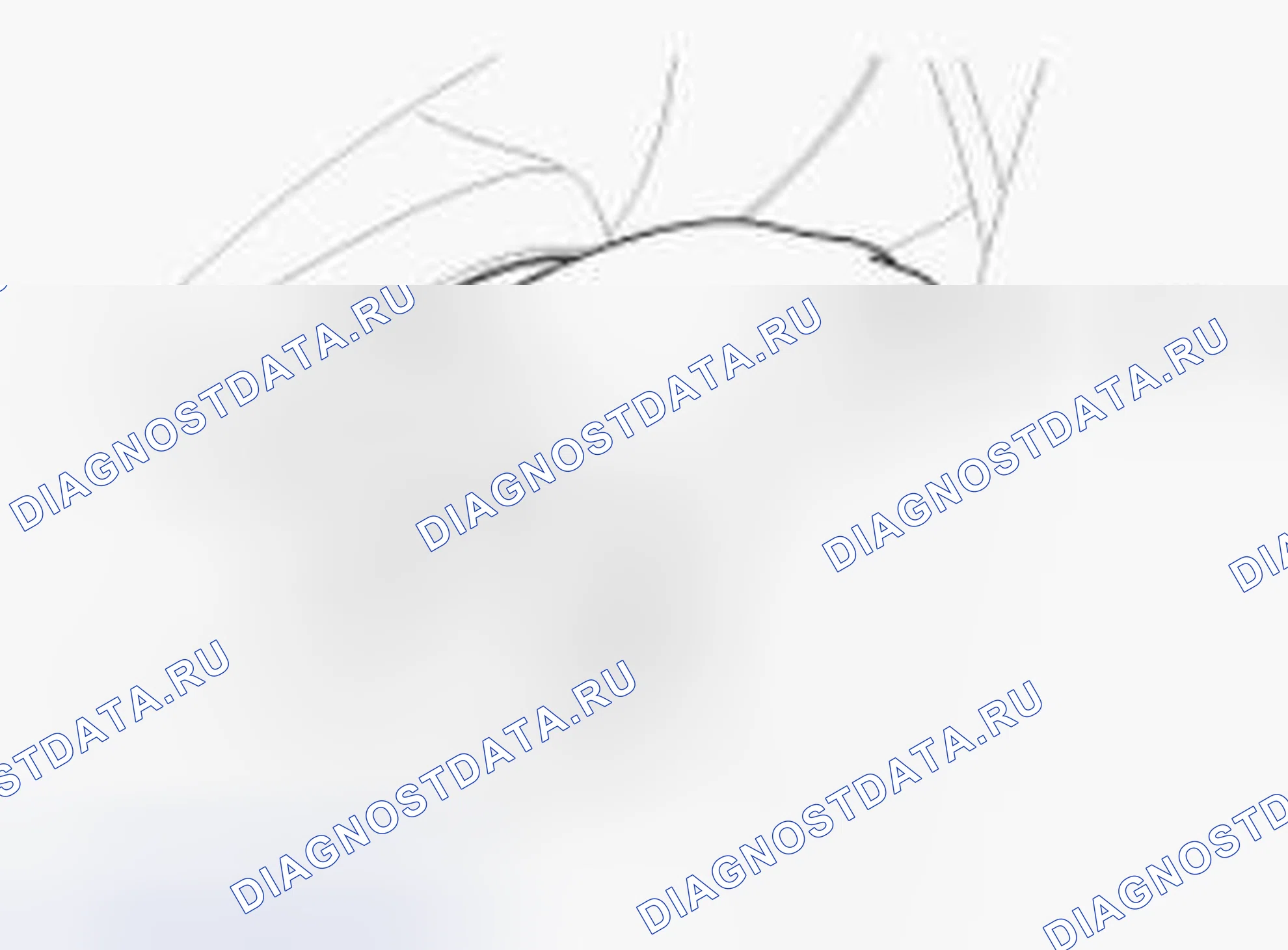 Рис. 14. Hyundai Accent IV
