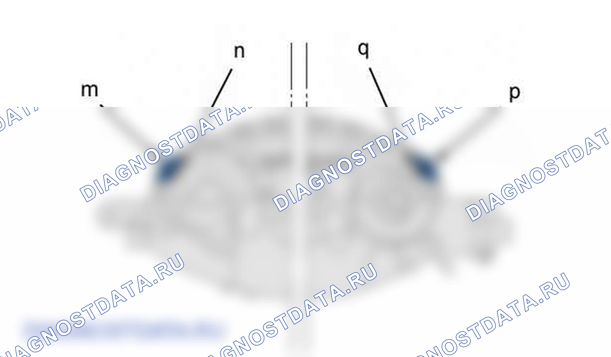 Повторная установка: двигателя — b1dp262d. Citroen C5 I рестайлинг