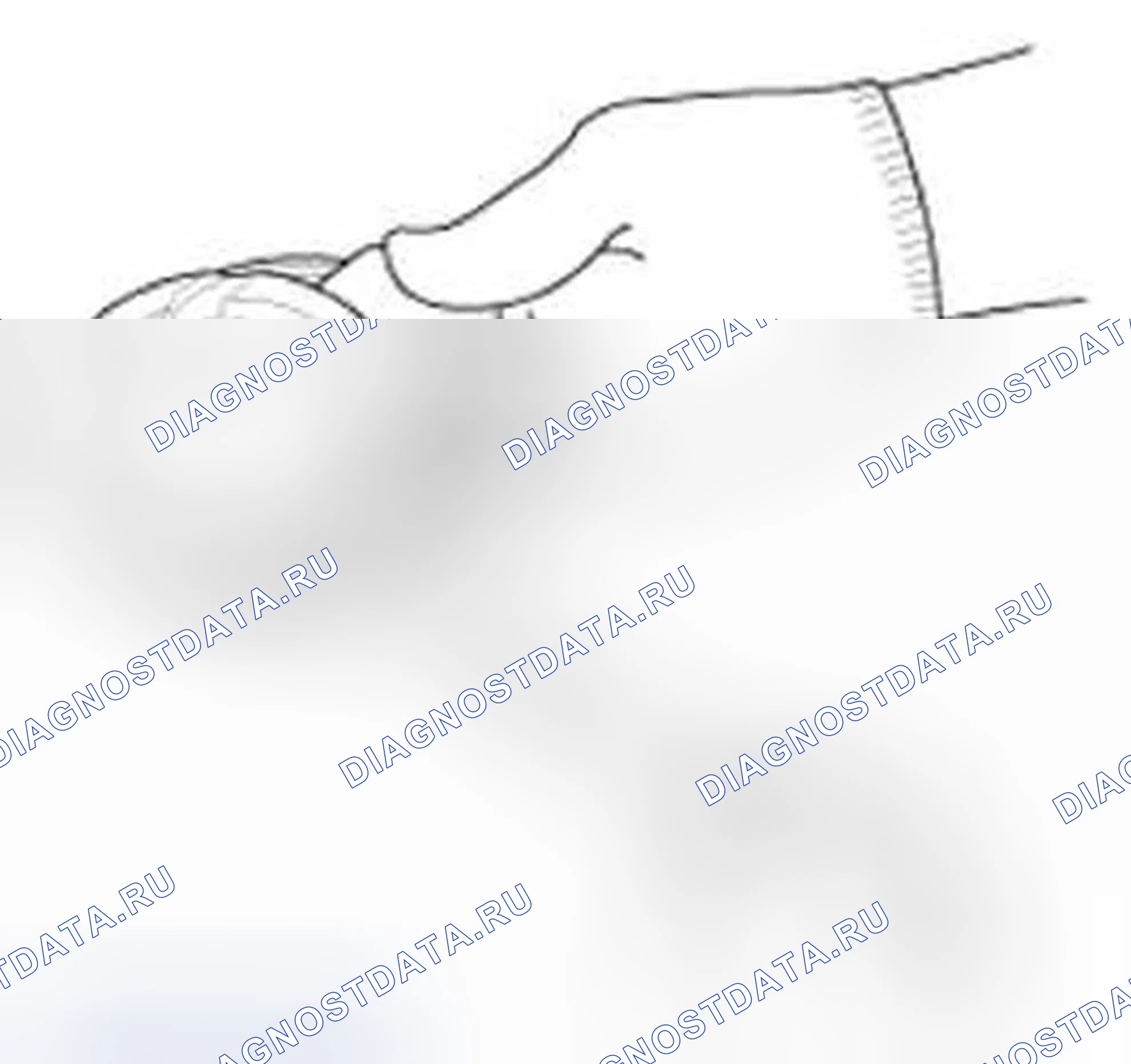 Рис. 171: Поршень и поршневые кольца. Hyundai Veloster I
