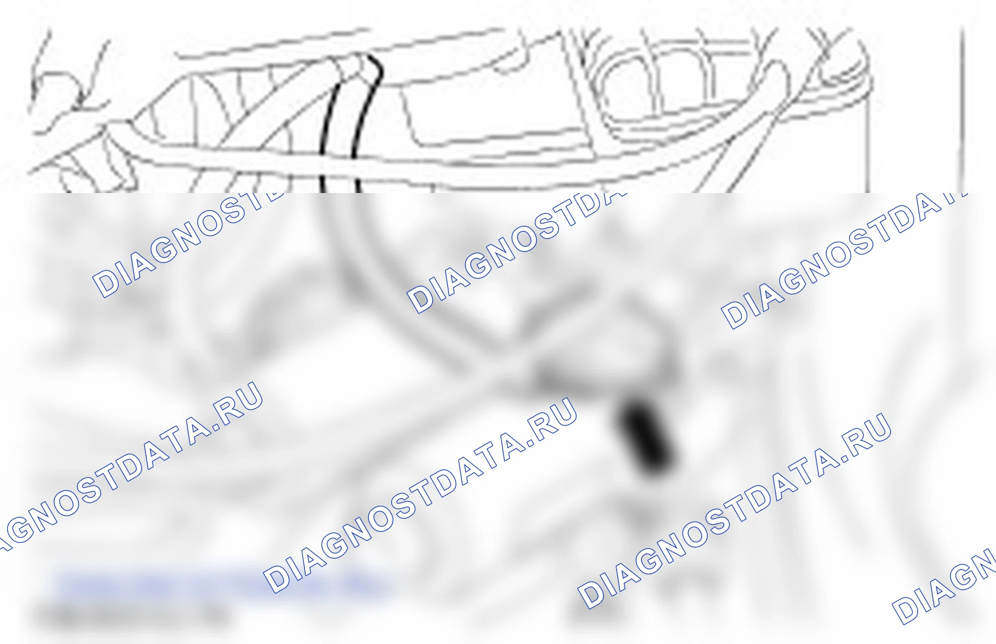 трансмиссия — 1.25L Duratec-16V (Sigma)/1.4L Duratec-16V (Sigma)/1.6L Duratec-16V (Sigma): описание и работа. Ford Ikon I