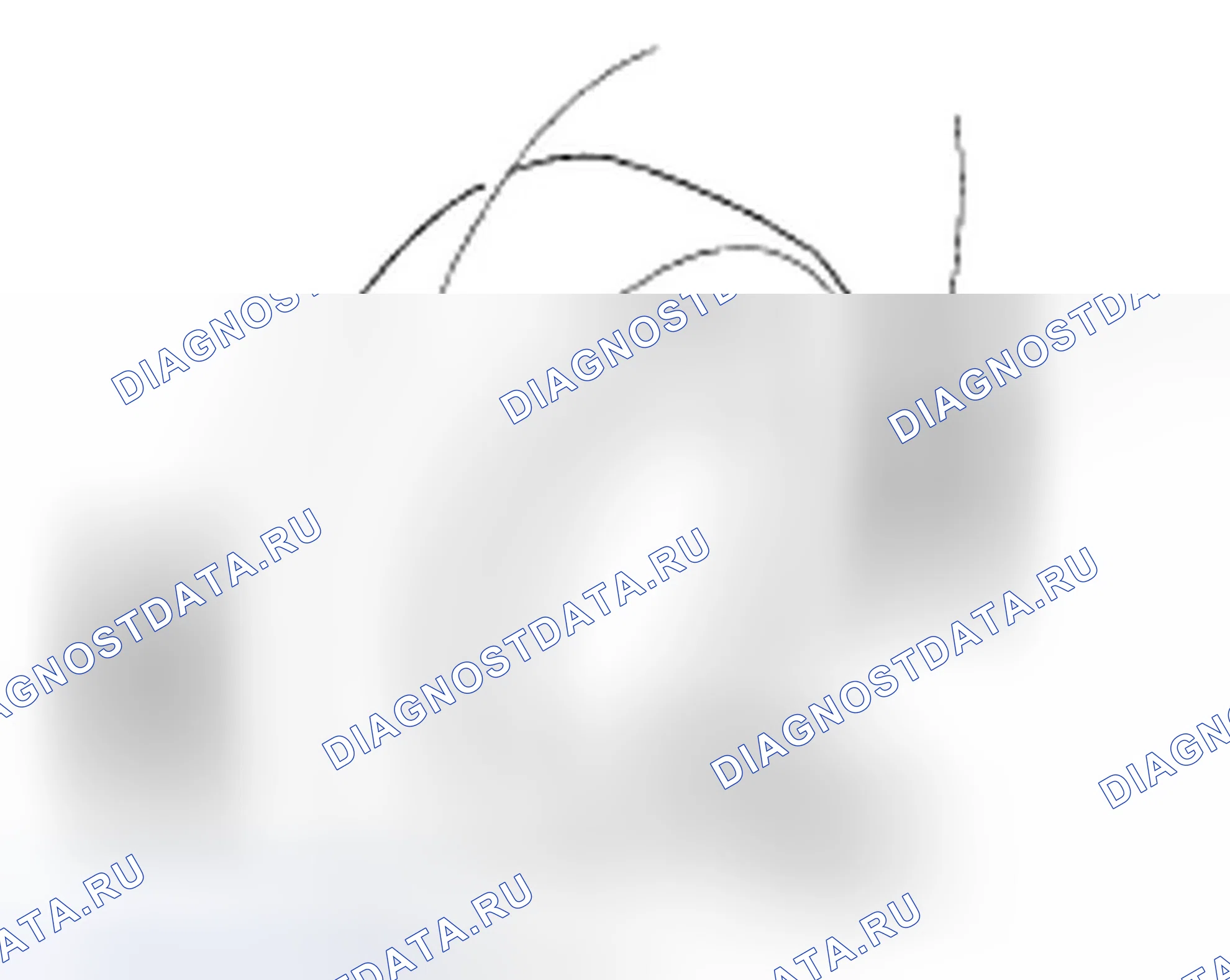 Рис. 10: Контроль биения колес. Acura TSX I