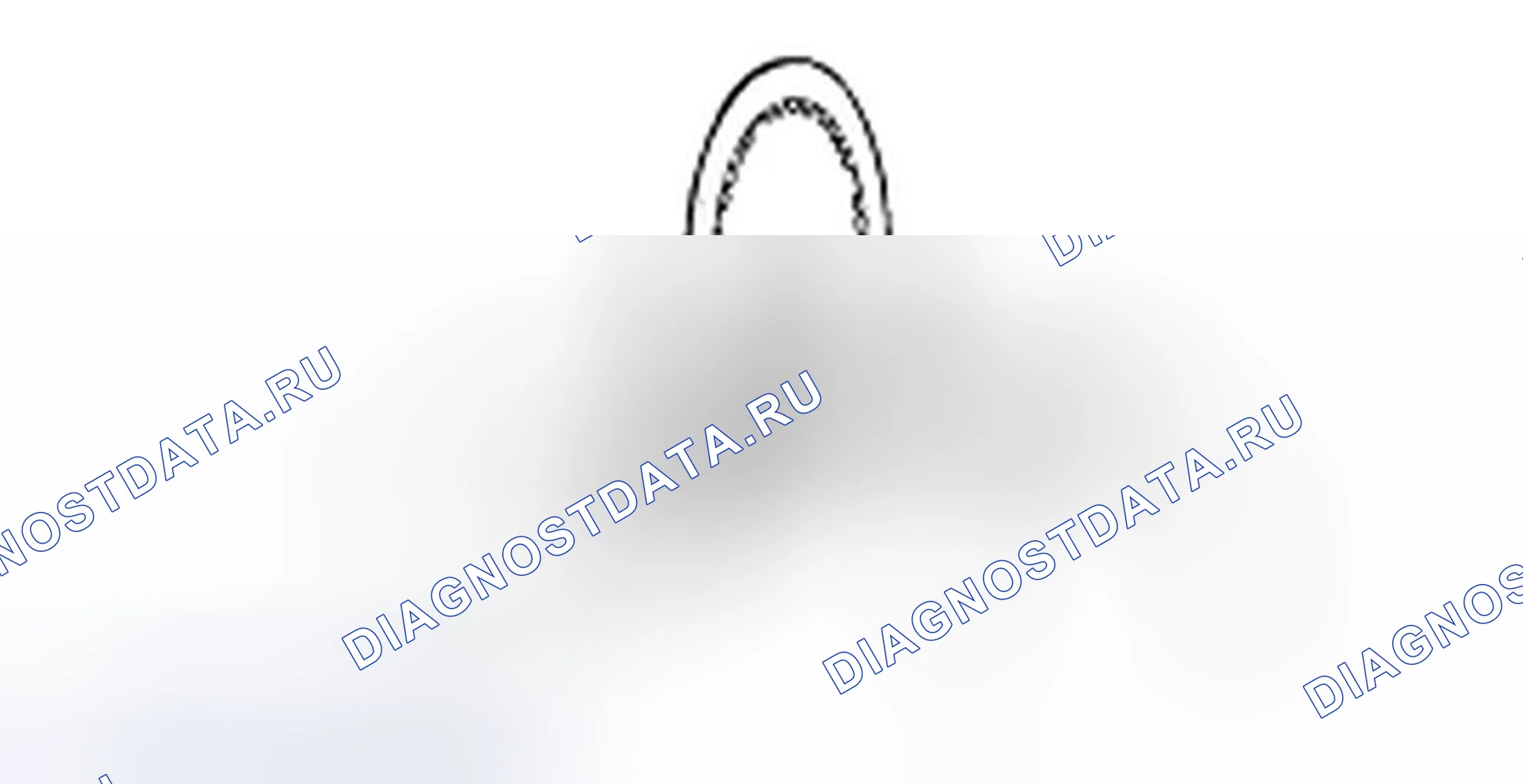 Проверка муфты реверса и овердрайва. Hyundai H-1 A1