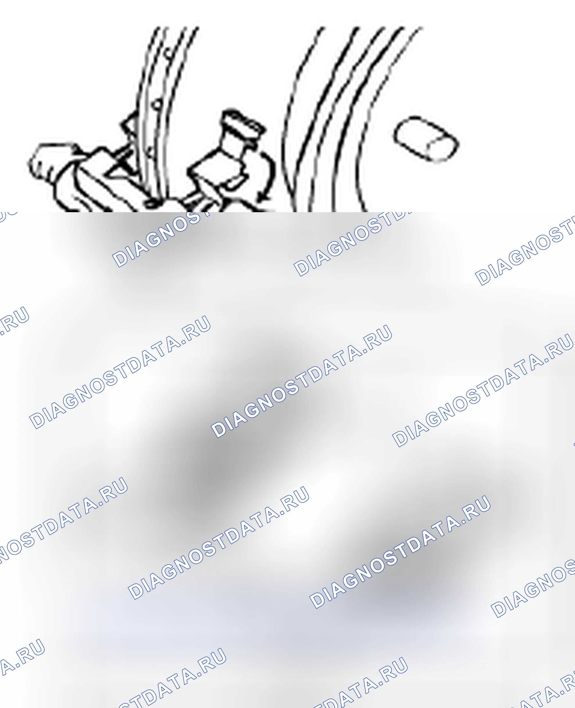 Рис. 43: Установка. Suzuki SX4 I