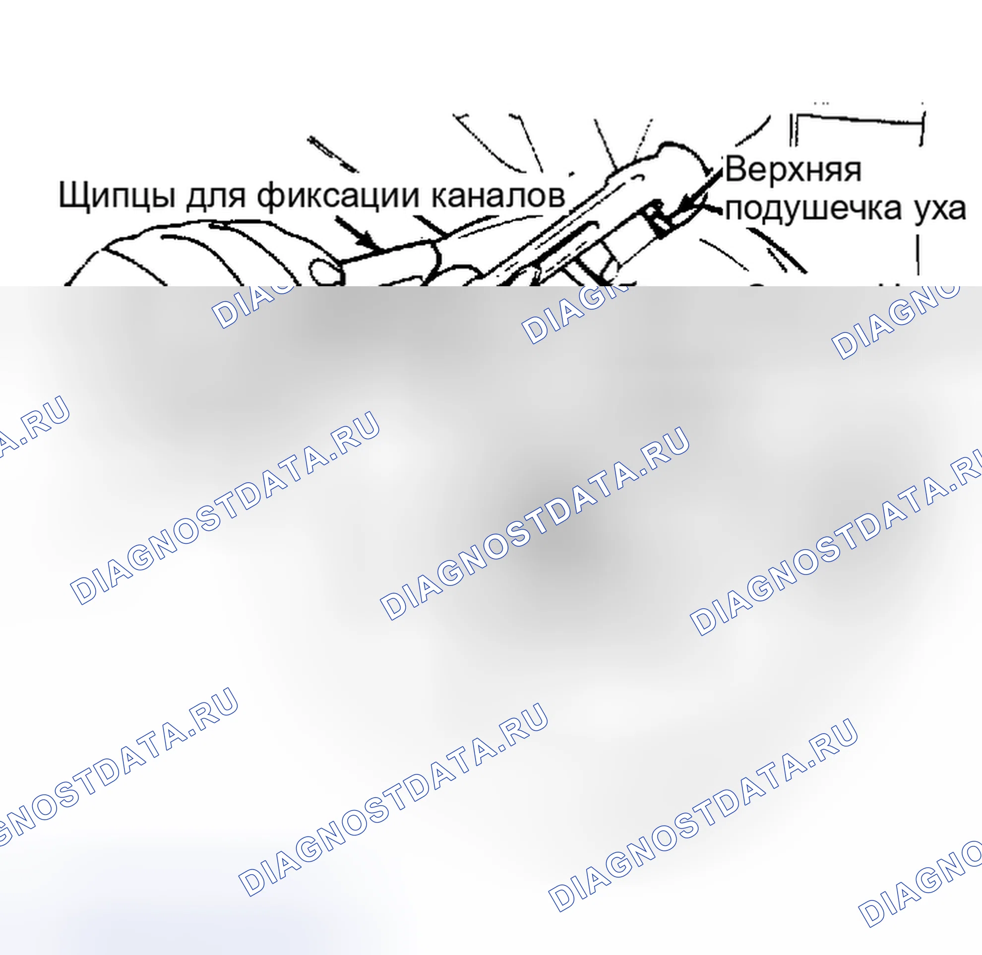 Рис. 12: Обжимные лапки на внешнем башмаке. Chevrolet Impala VI