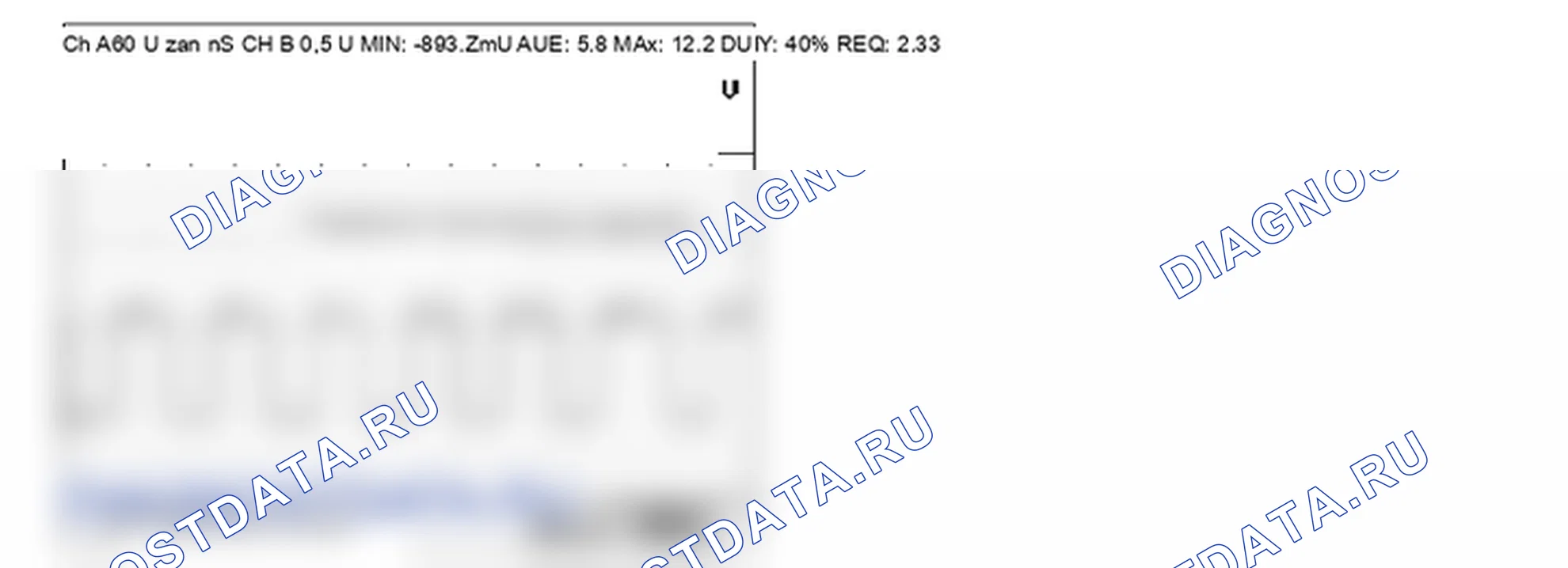P0500: Датчик скорости транспортного средства. Kia Sorento BL