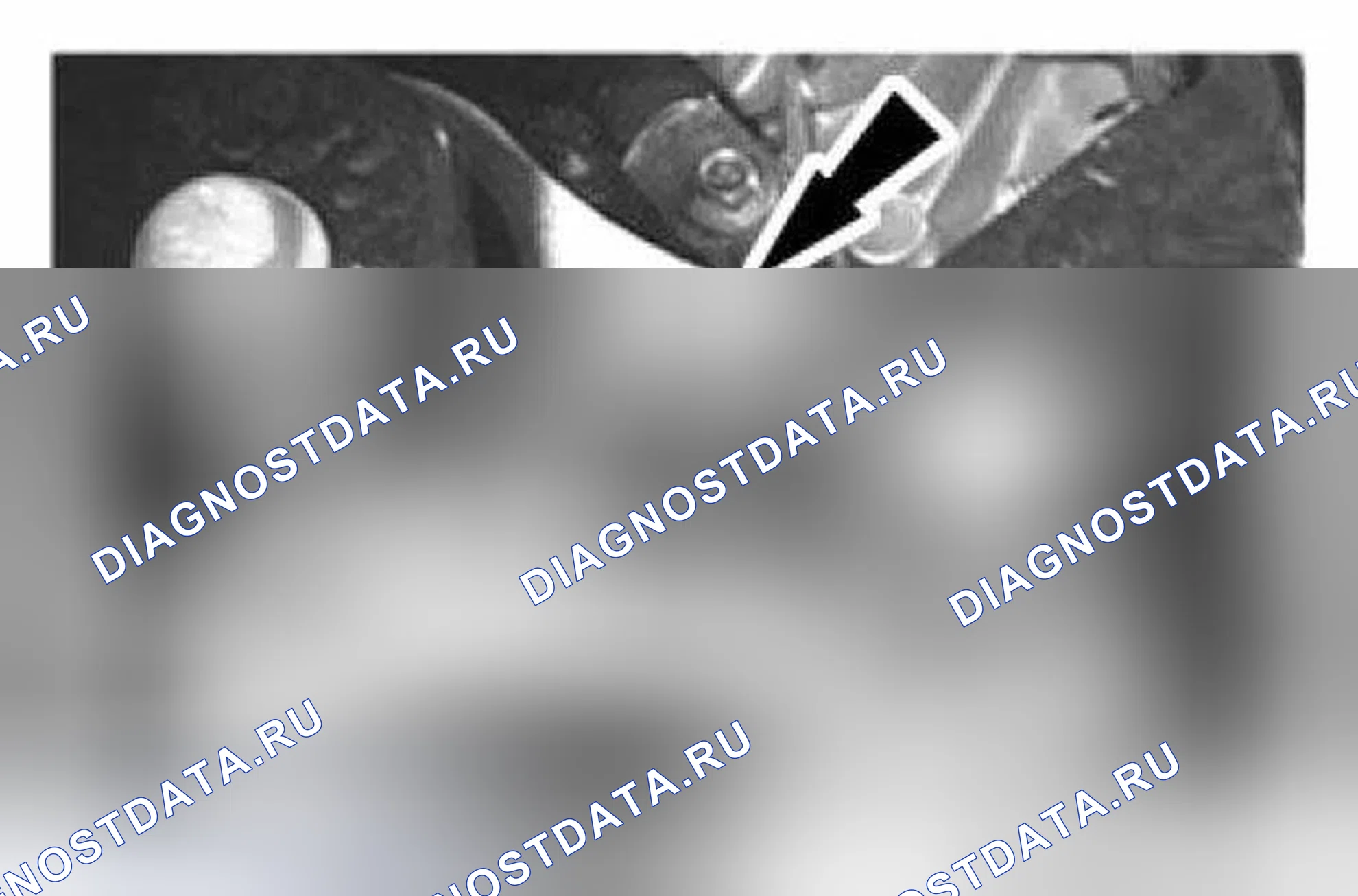 Рис. 82: Установка. Ford Fiesta Mk6