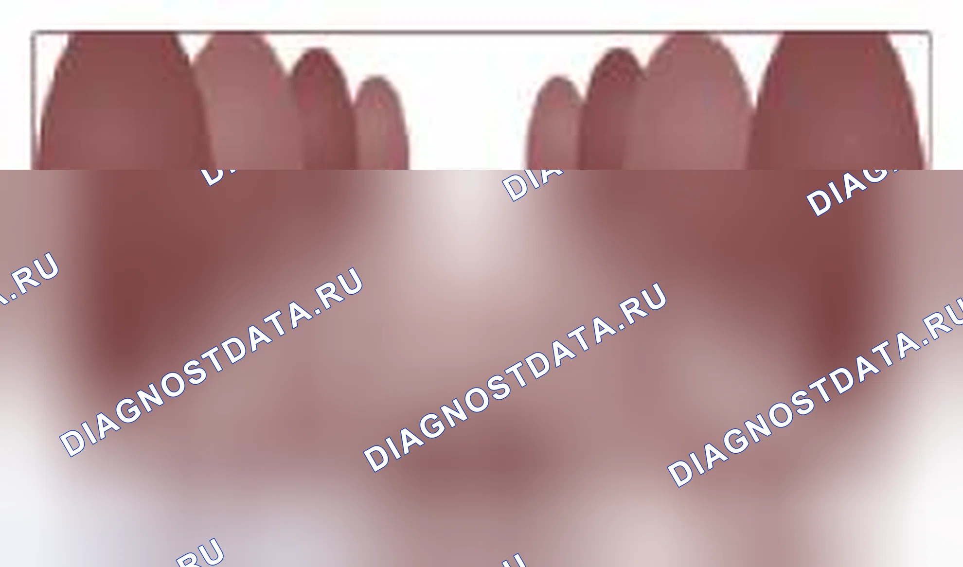 Рис. 7. Kia Magentis II рестайлинг