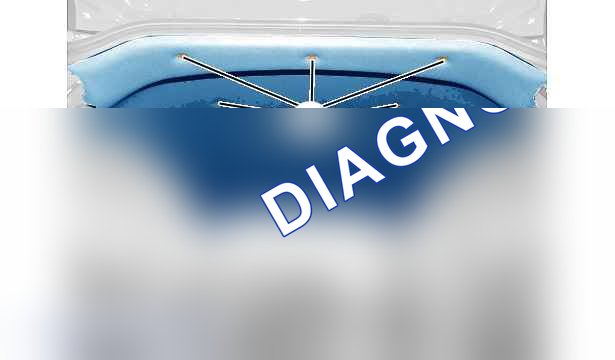 Снятие - установка: облицовка крыши — c5gg0snd. Peugeot iON I