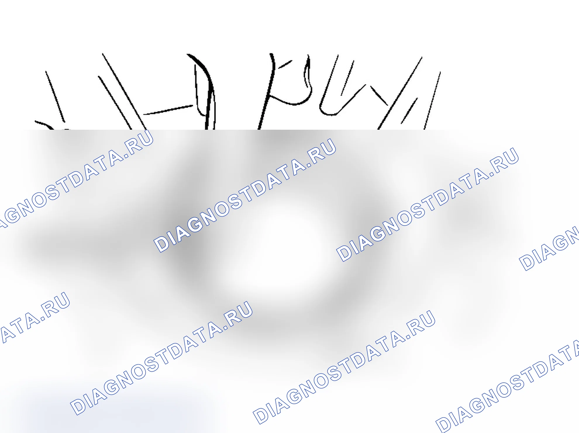 Рис. 165: <<A>> СНЯТИЕ НАРУЖНОЙ ОБОЙМЫ. Mitsubishi Lancer Ralliart IX рестайлинг