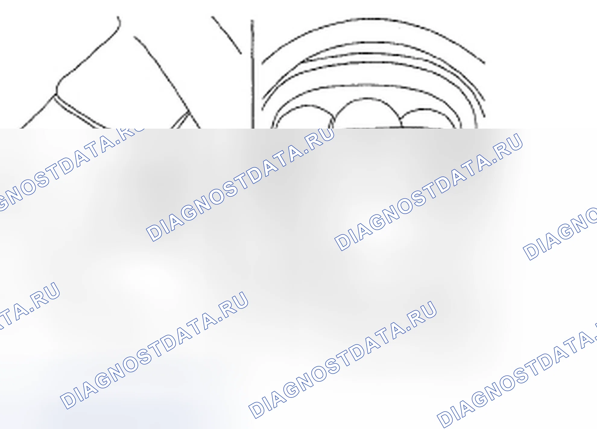 Рис. 2: ДЕМОНТАЖ. Hyundai Elantra IV