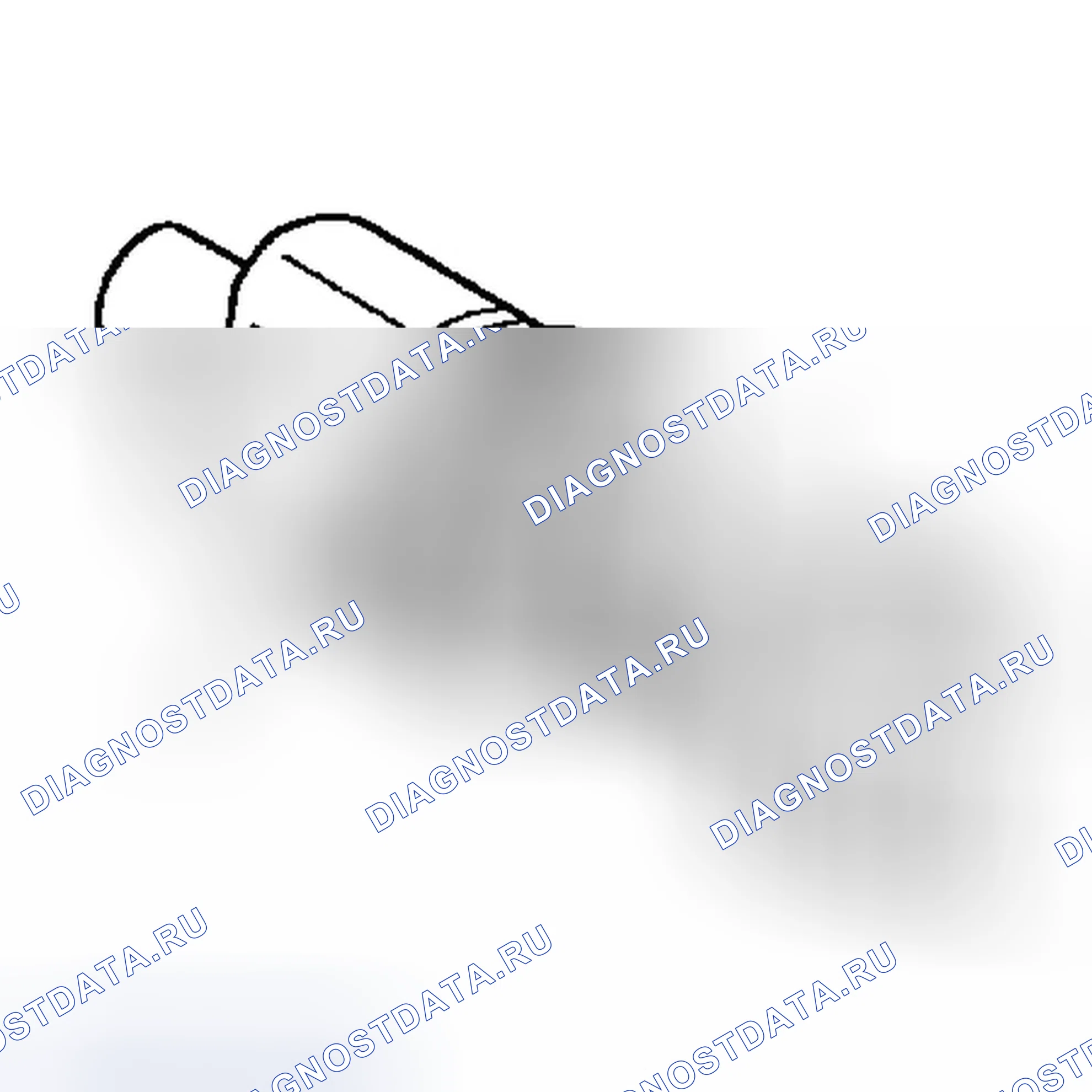 Рис. 5: Процедура разборки. Buick Rendezvous I