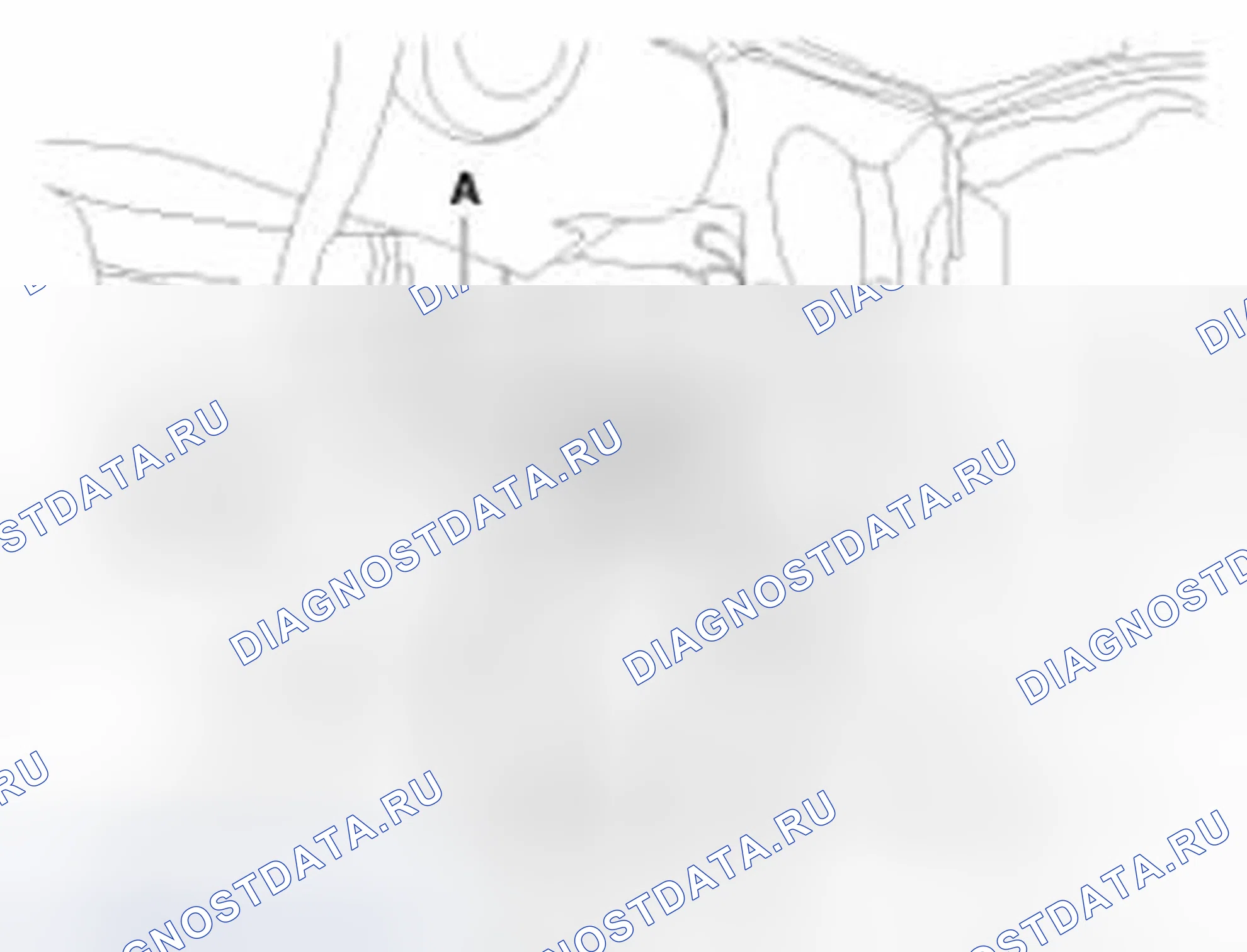 Рис. 16: Демонтаж. Hyundai Elantra V