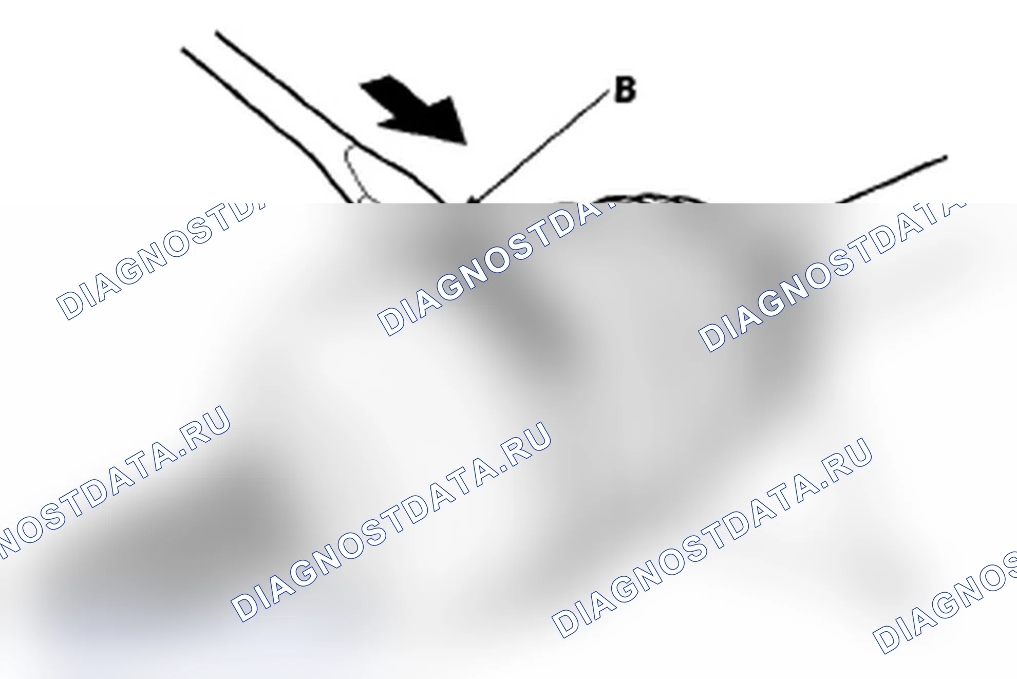 Рис. 18: Внешняя сторона соединения. Acura RL II