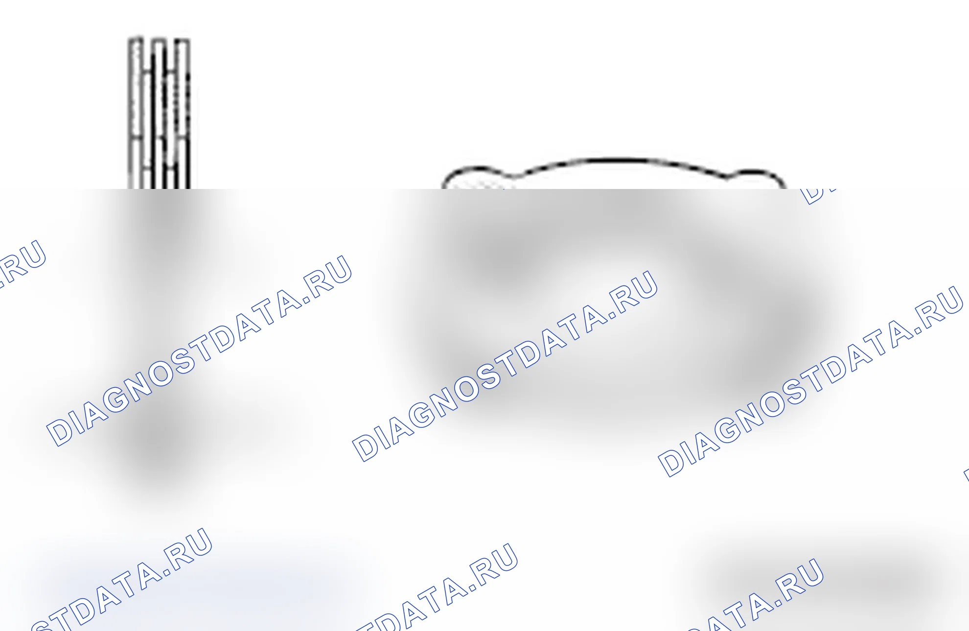 Рис. 136: >> A <<УСТАНОВКА КОРПУСА ДИФФЕРЕНЦИАЛА B. Mitsubishi Lancer Ralliart X рестайлинг