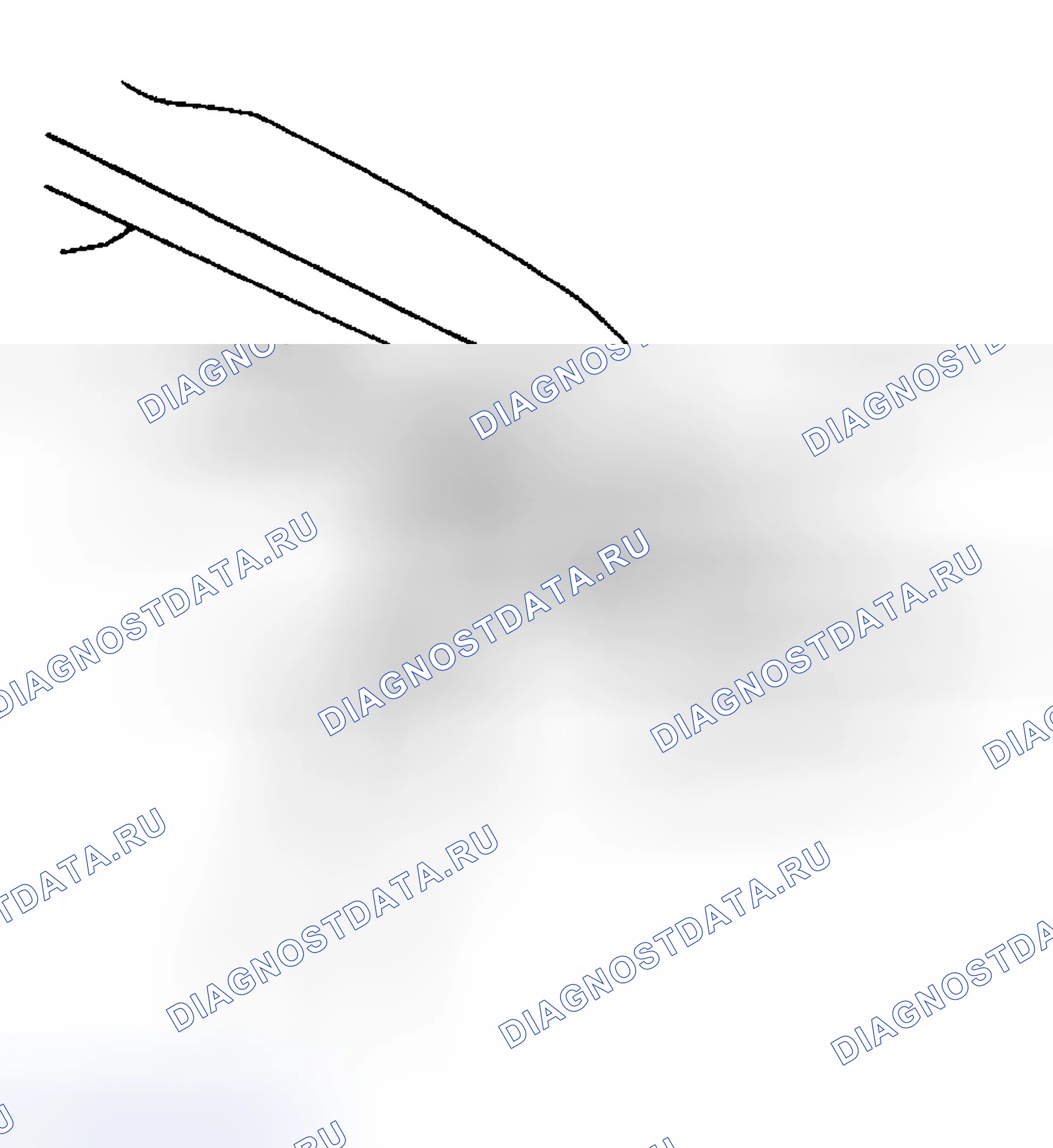 Рис. 6: Порядок демонтажа. Hyundai Venue I