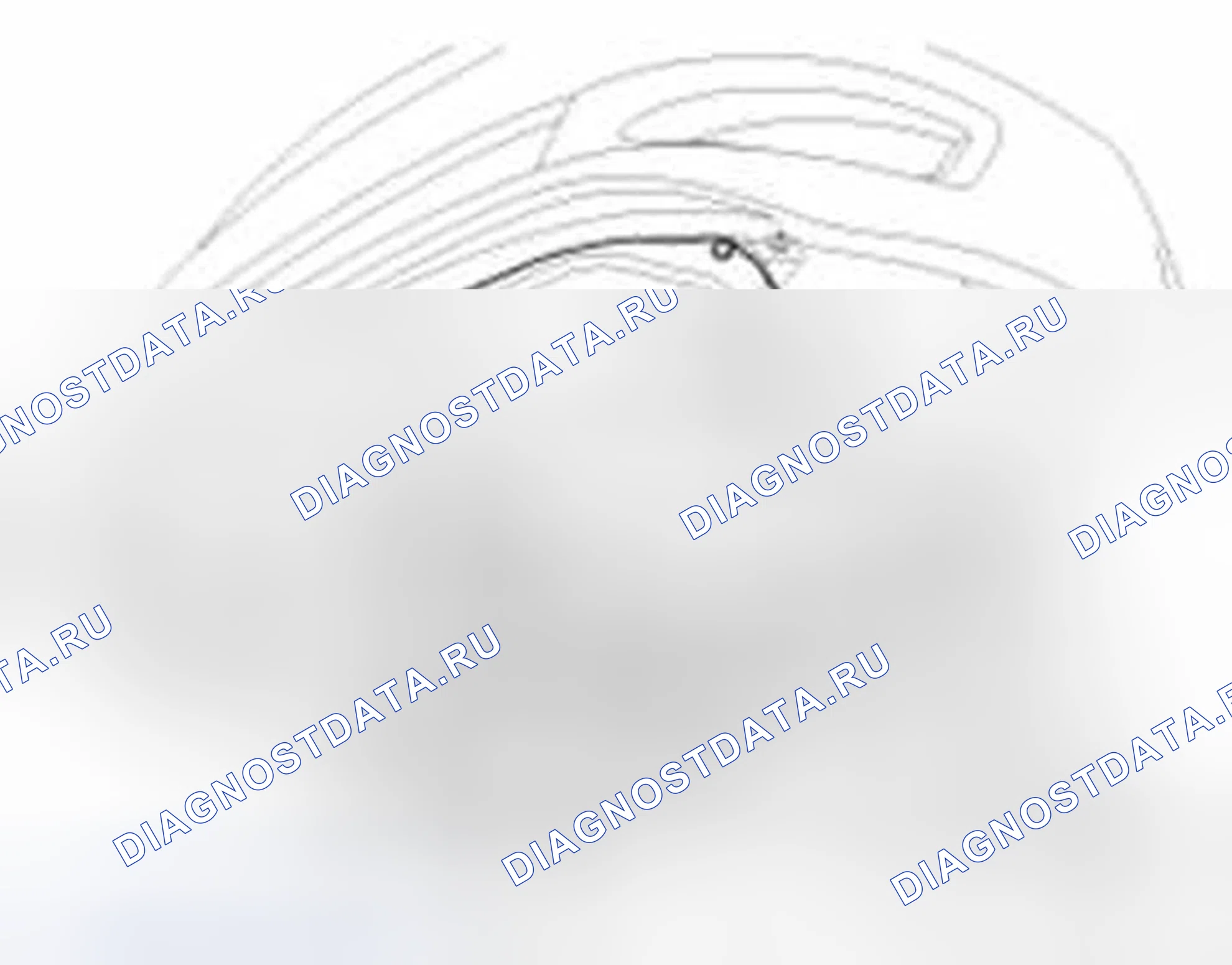 Рис. 139: Удаление. Hyundai Sonata VI