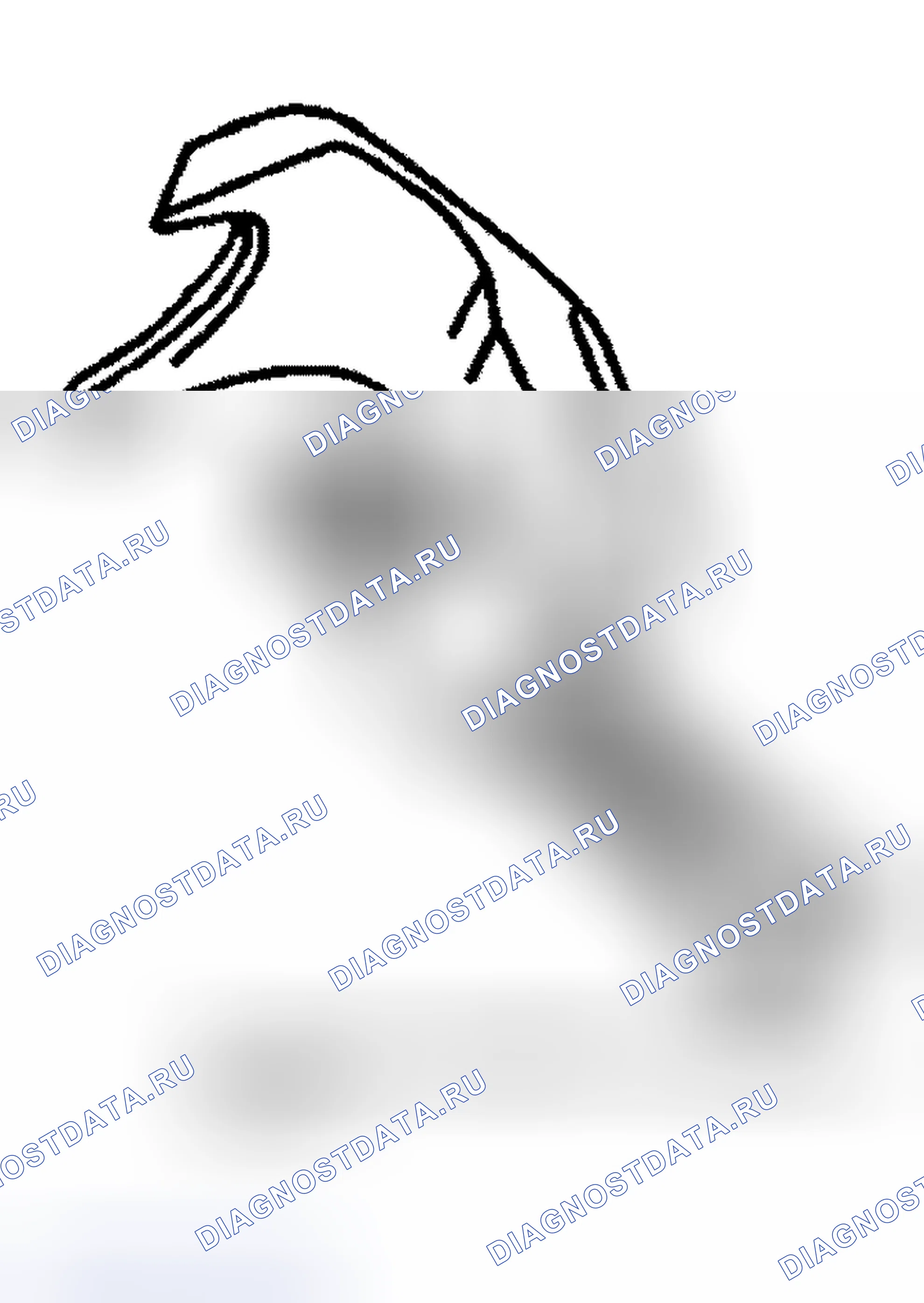 Рис. 1: СПЕЦИАЛЬНЫЕ ИНСТРУМЕНТЫ. Hyundai Venue I