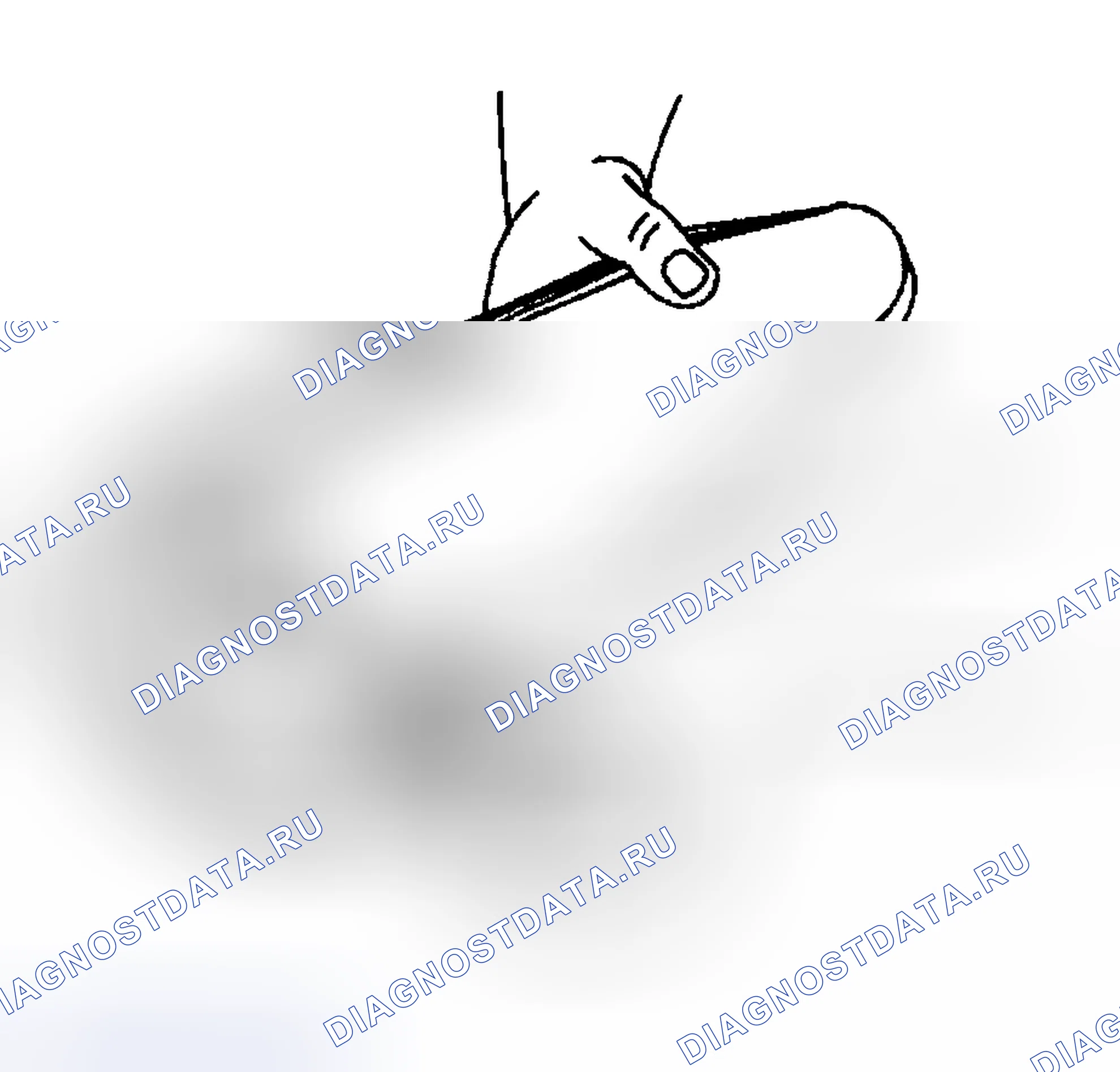 Рис. 172: Процедура установки. Hyundai Venue I