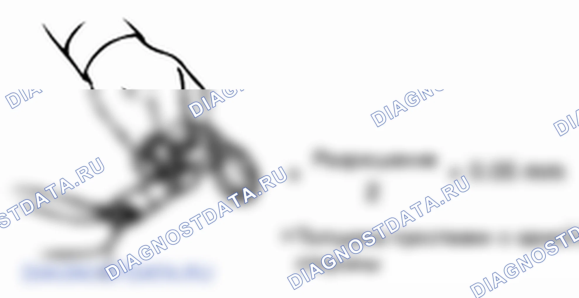 Сборка передней несущей панели дифференциала (4WD). Hyundai H-1 A1