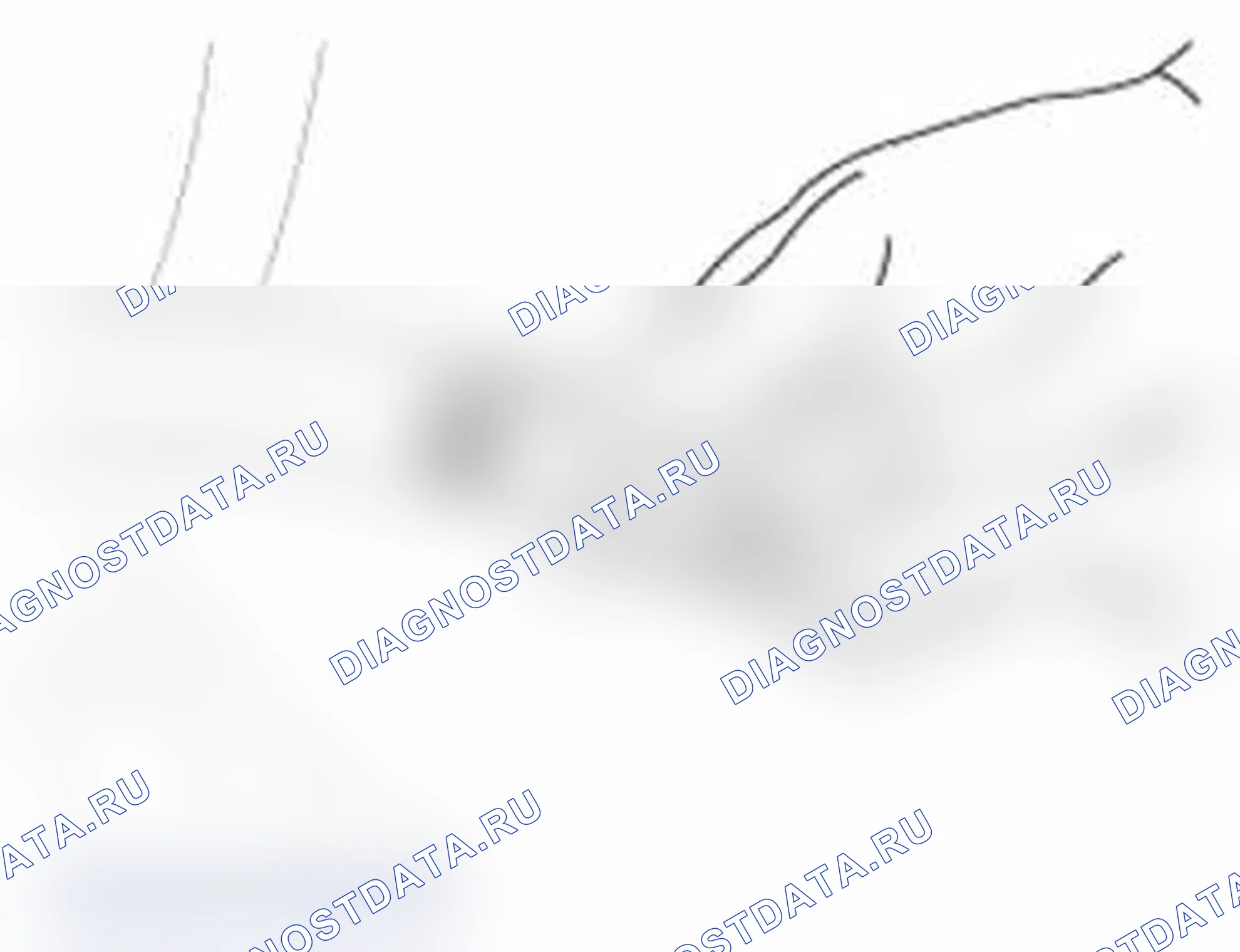 Рис. 9: Проверка тестирования и диагностики систем управления двигателя. Hyundai Santa Fe II рестайлинг