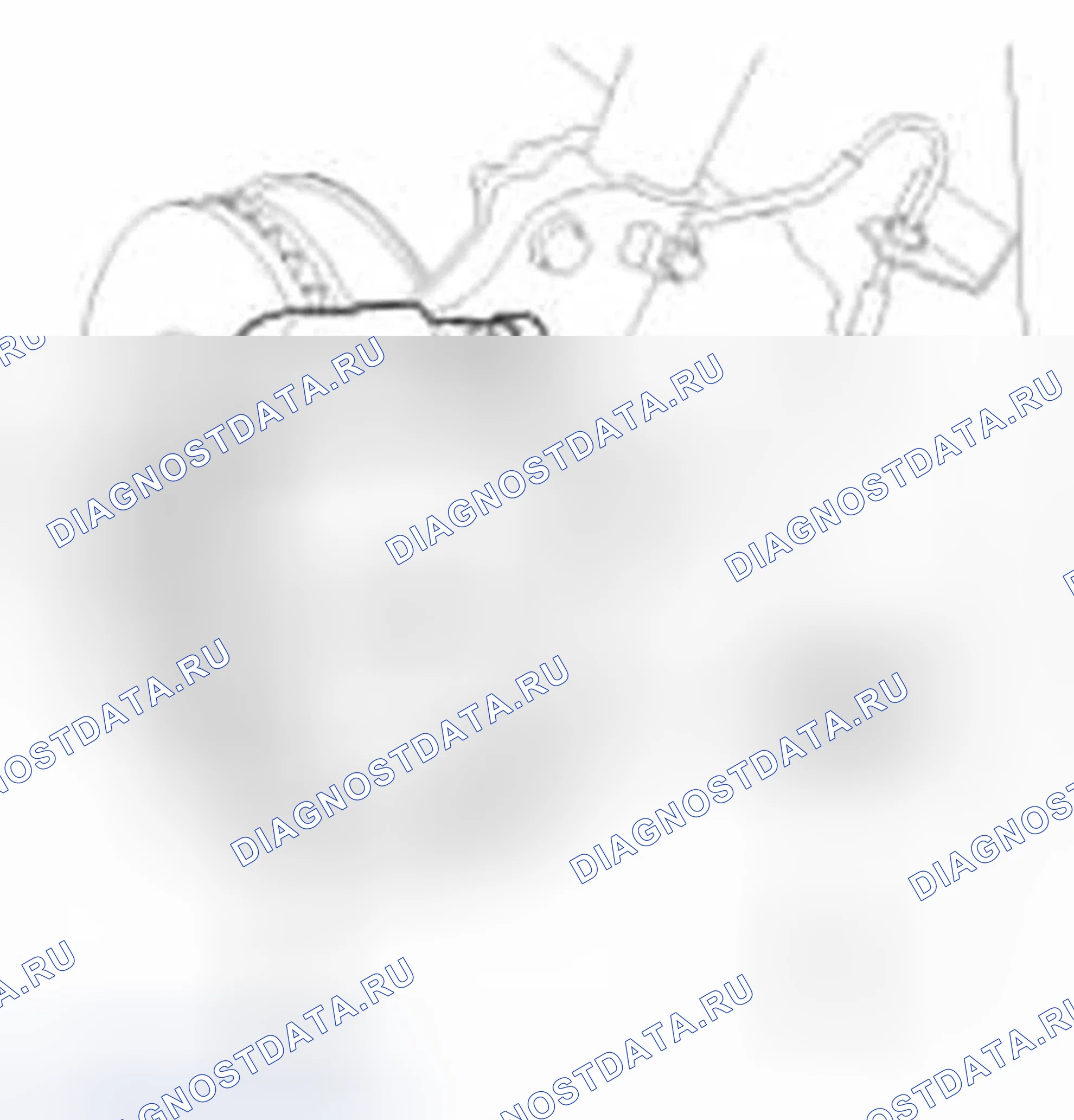 Рис. 13: Передние тормозные колодки. Hyundai Elantra V