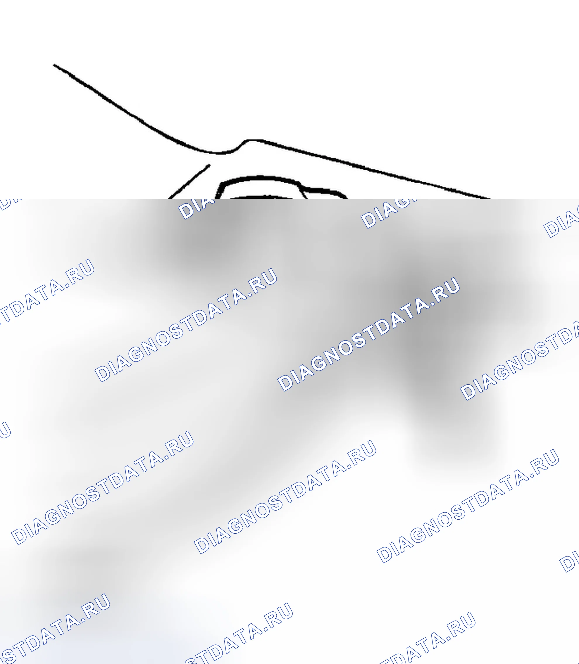 Рис. 21: ДЕМОНТАЖ. Hyundai Tiburon II