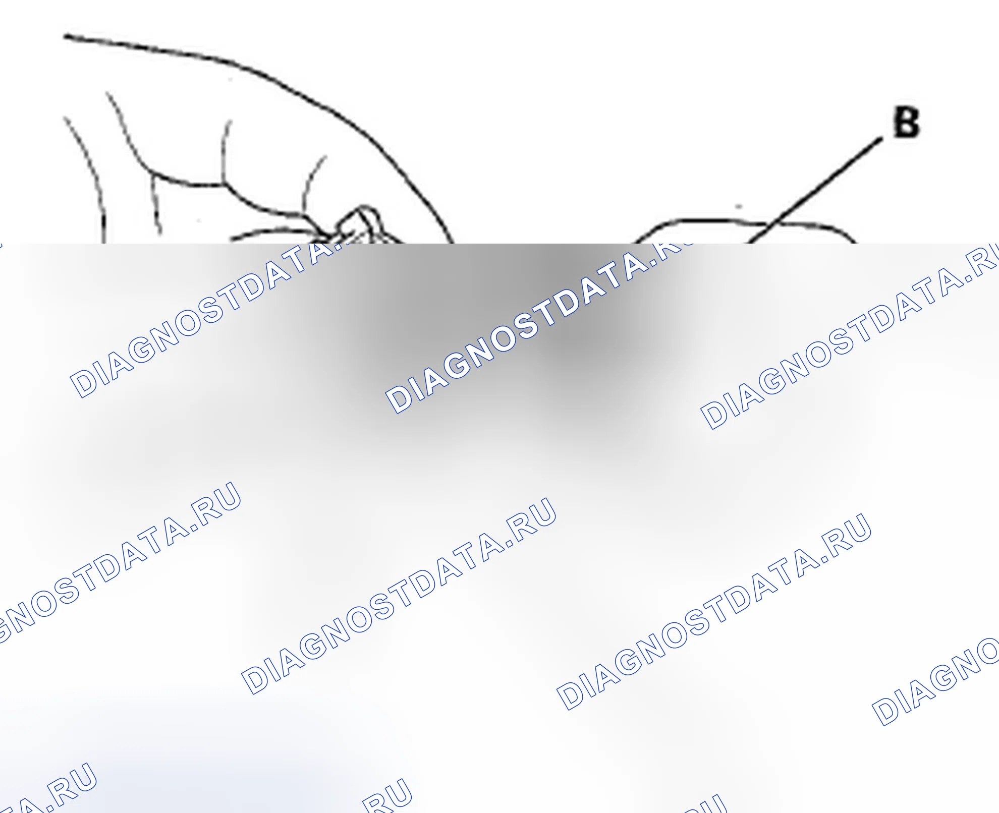 Рис. 486: Разъединение. Acura TSX II