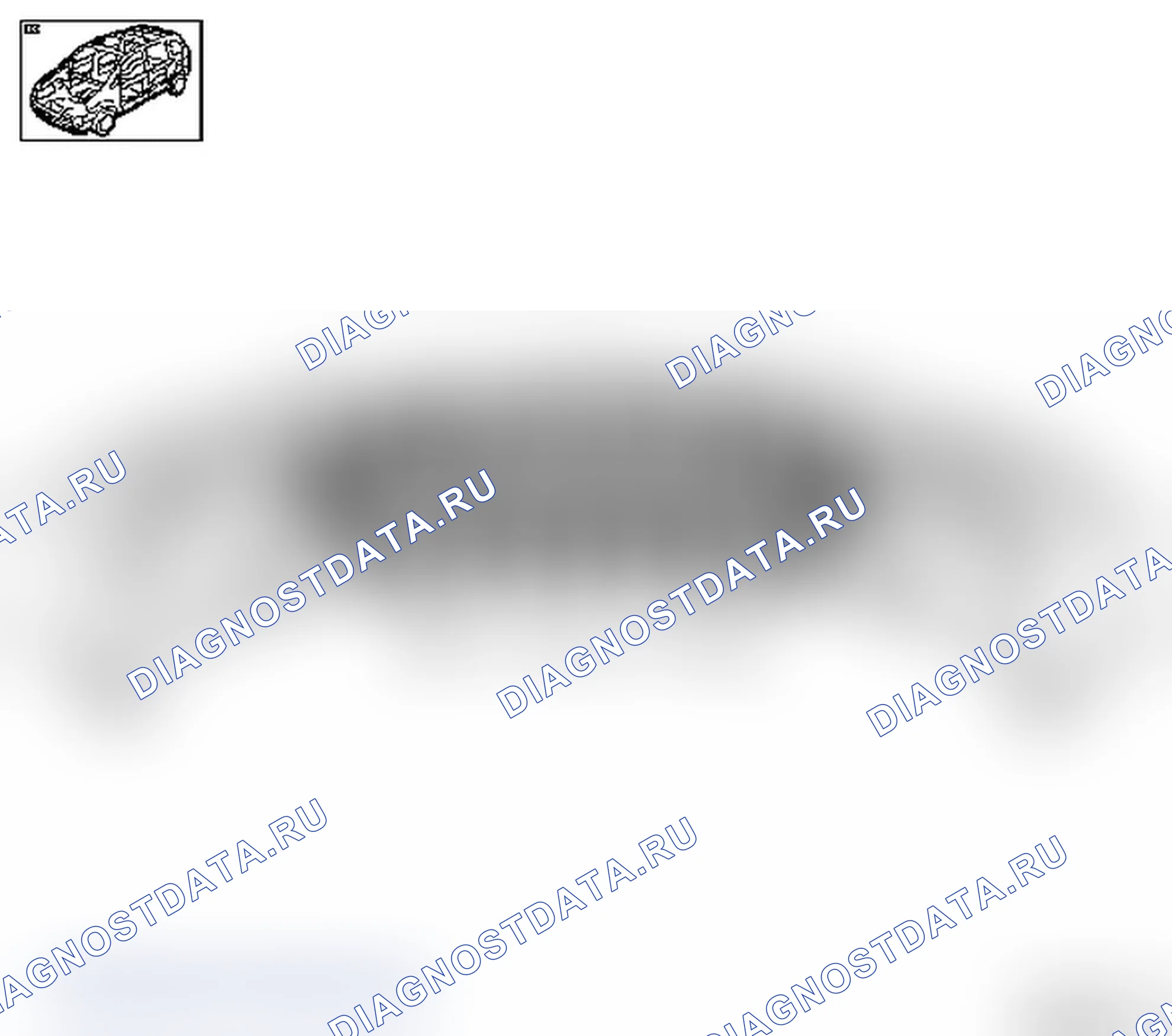 Демонтаж и монтаж решетки передней обшивки. Opel Combo C