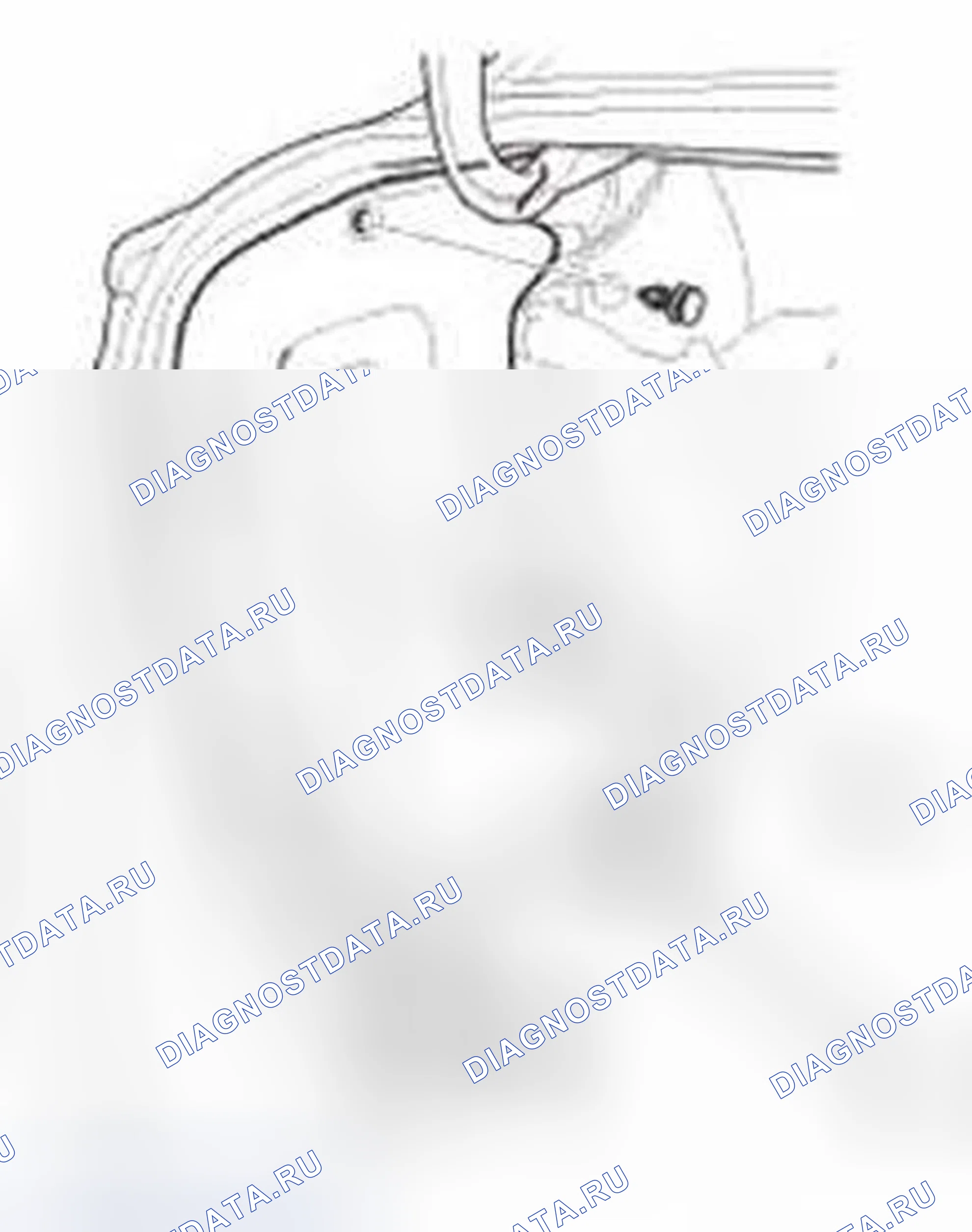 Рис. 164. Honda Civic IX