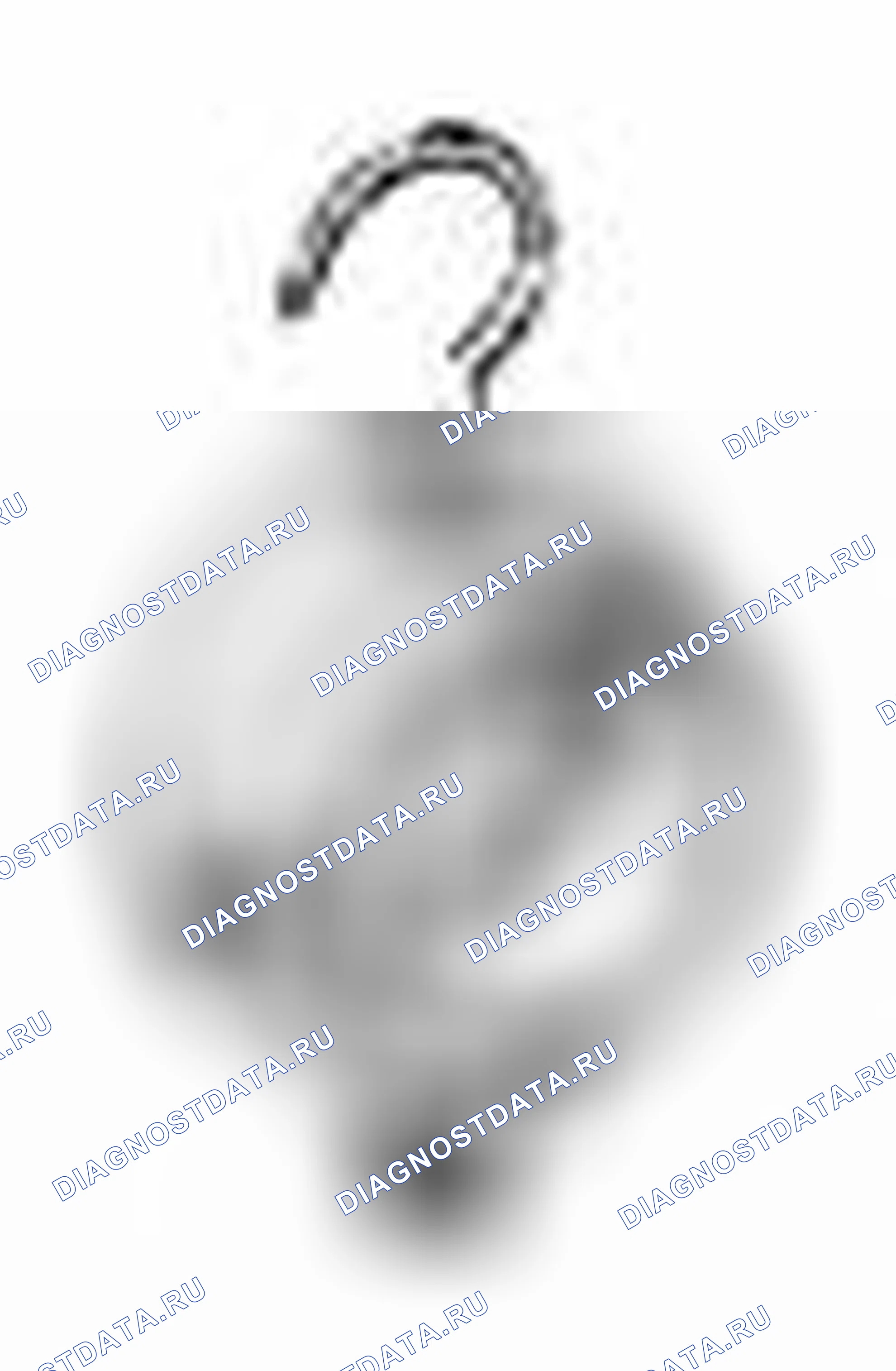 Рис. 43. Suzuki SX4 I рестайлинг