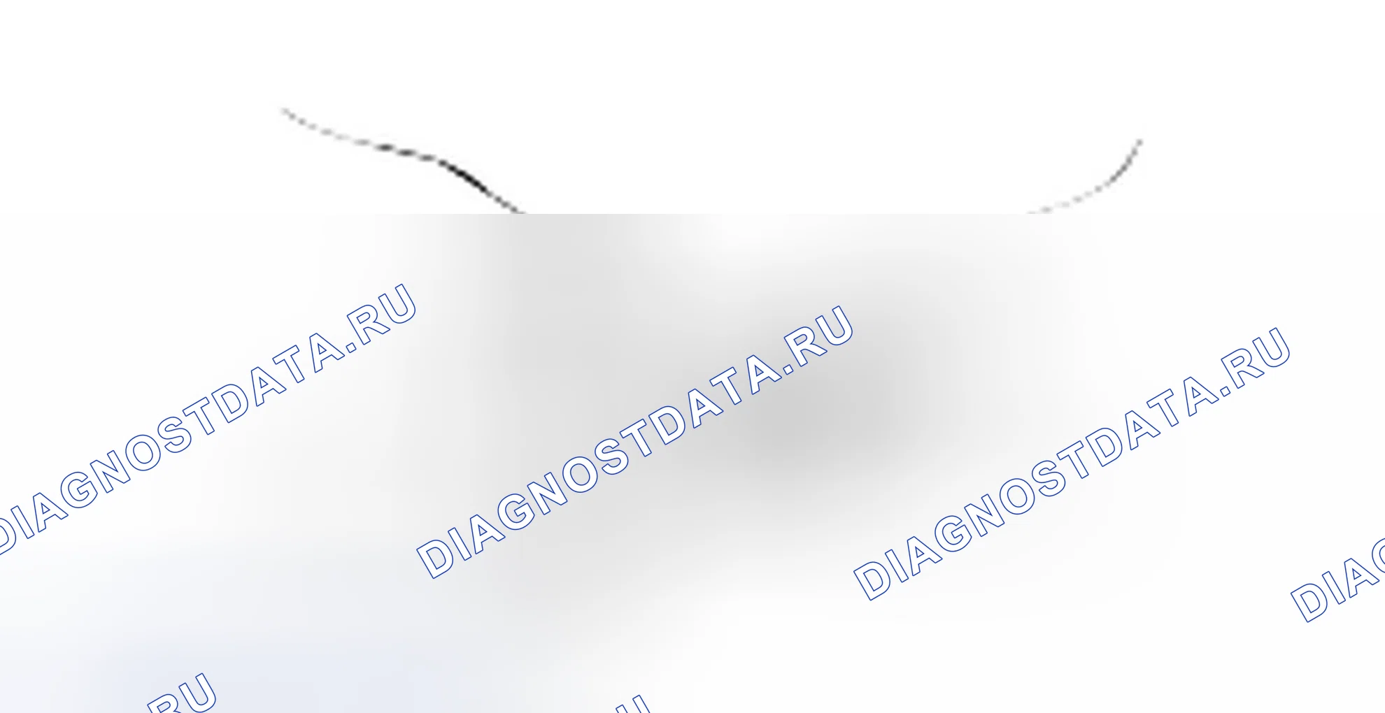 Разборка поддержки центра. Hyundai H-1 A1