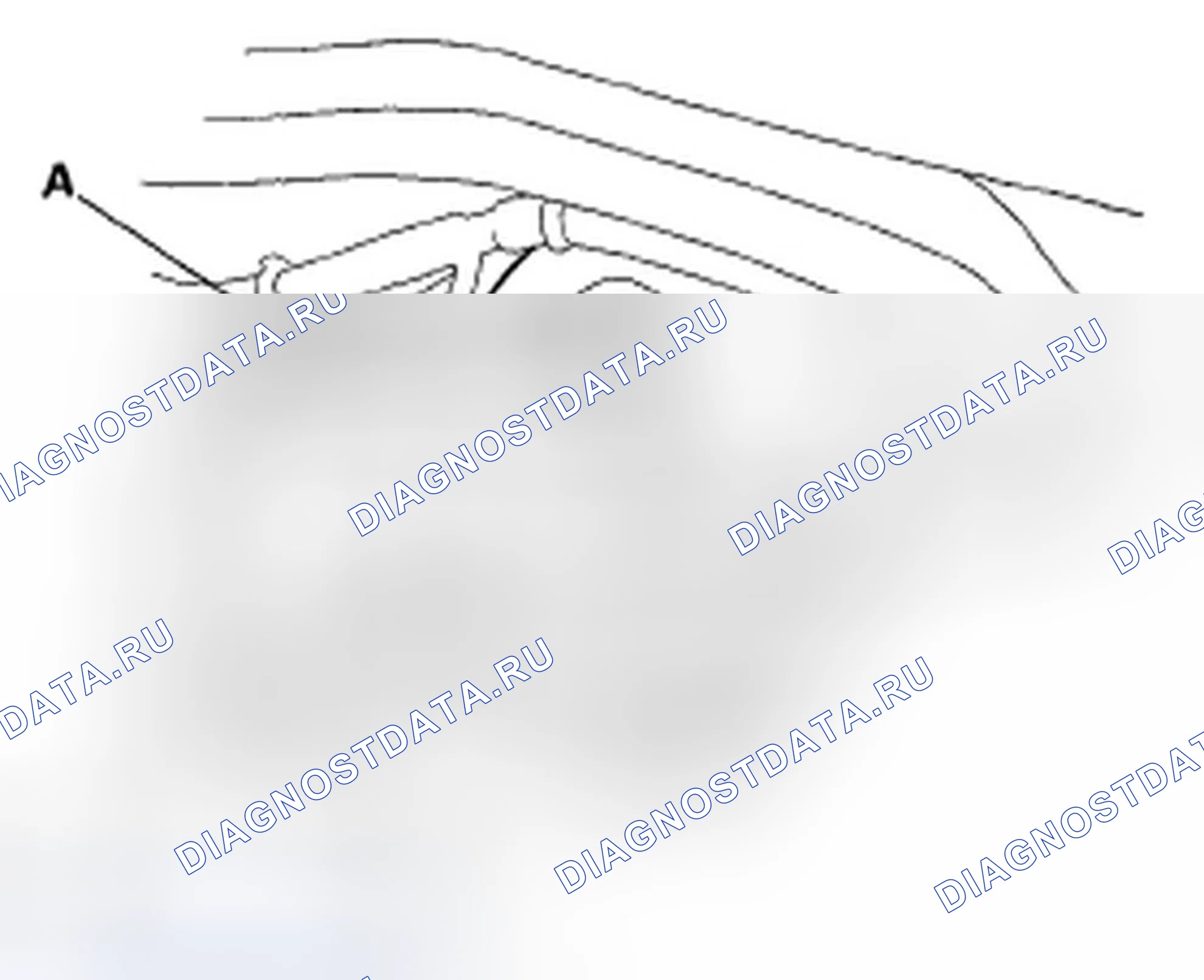 Рис. 14: Замена усилителя тормозов. Acura TSX I