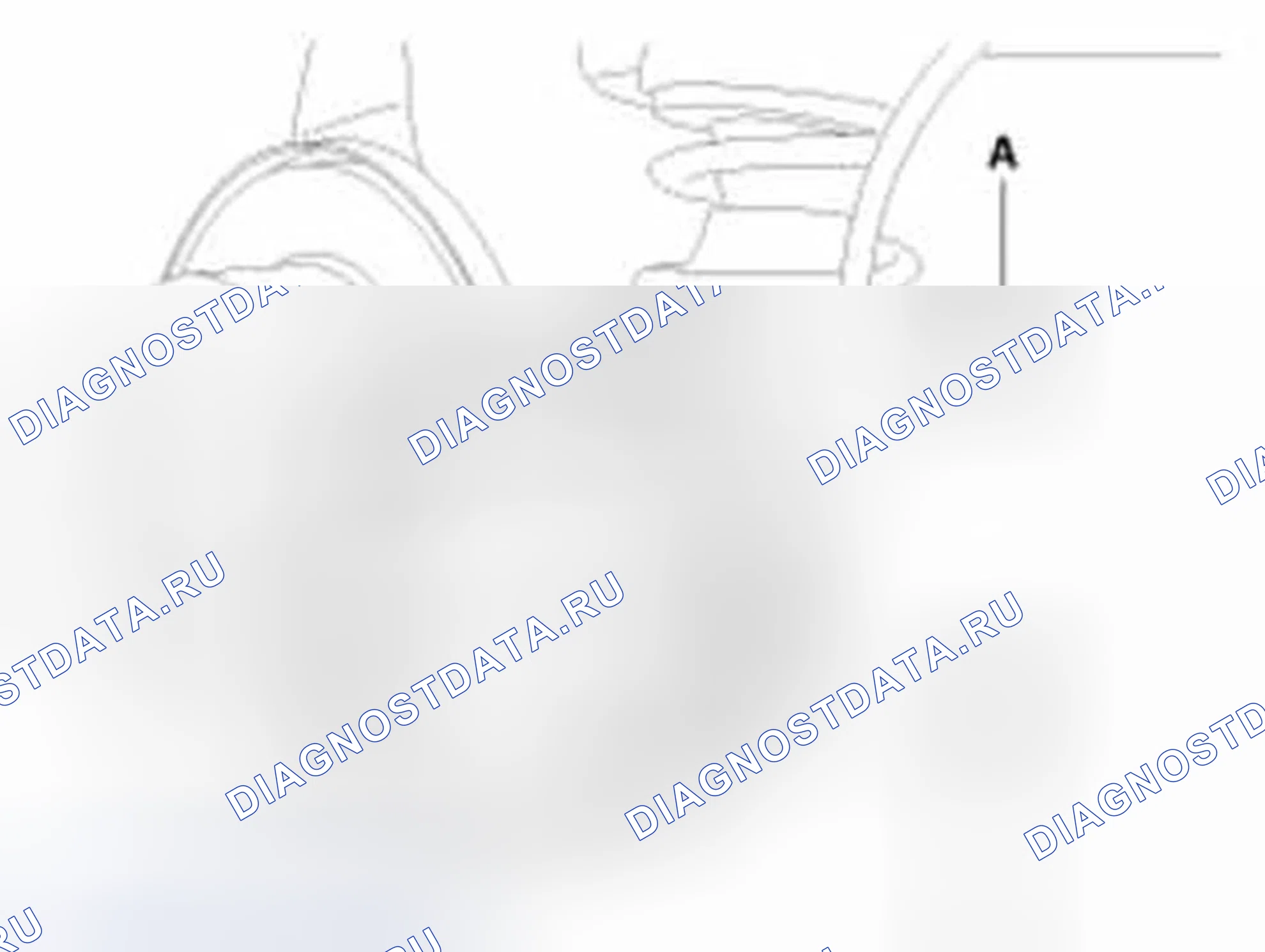 Рис. 23: Задние тормозные колодки. Hyundai Elantra V