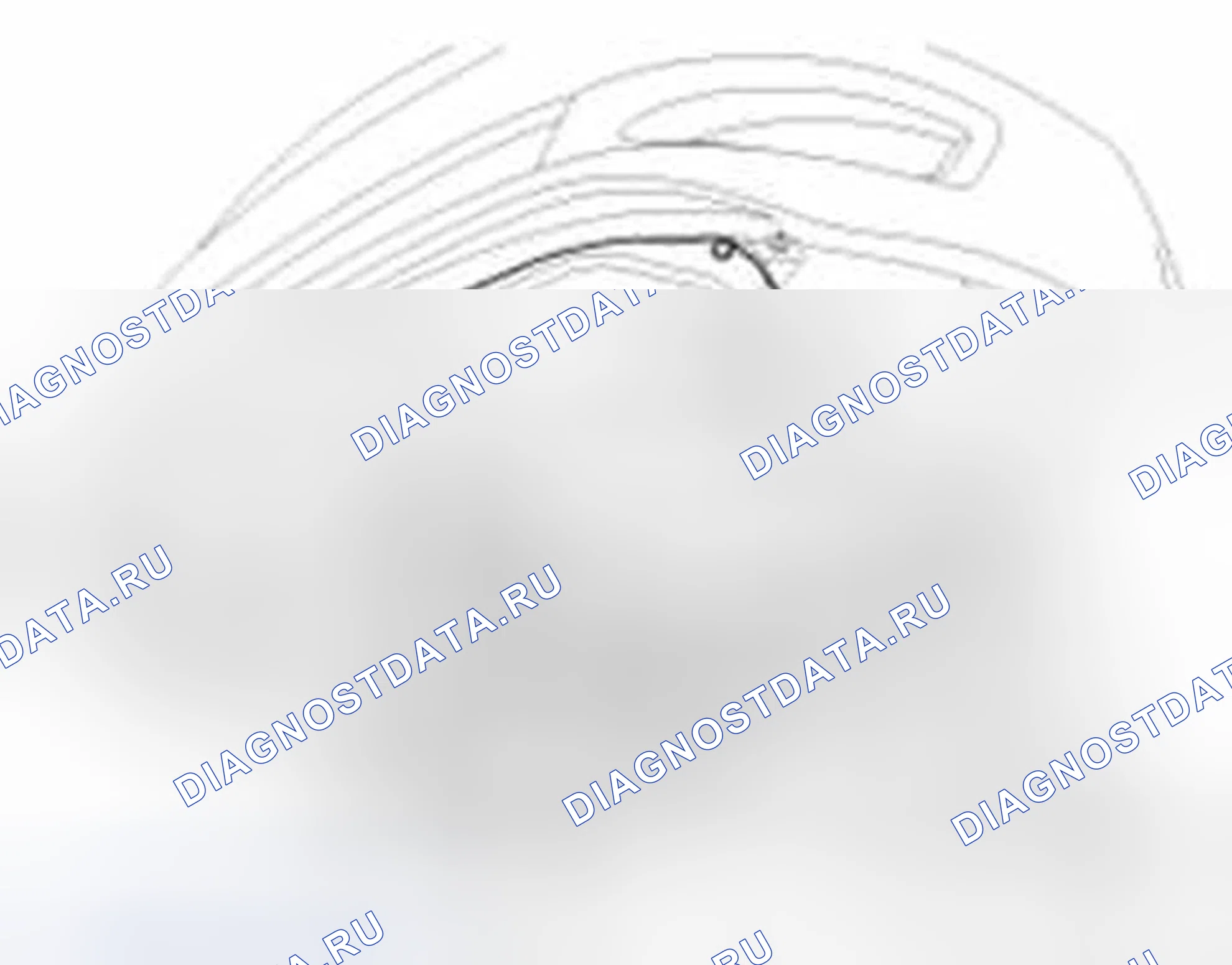 Рис. 116: Демонтаж. Hyundai Sonata VI