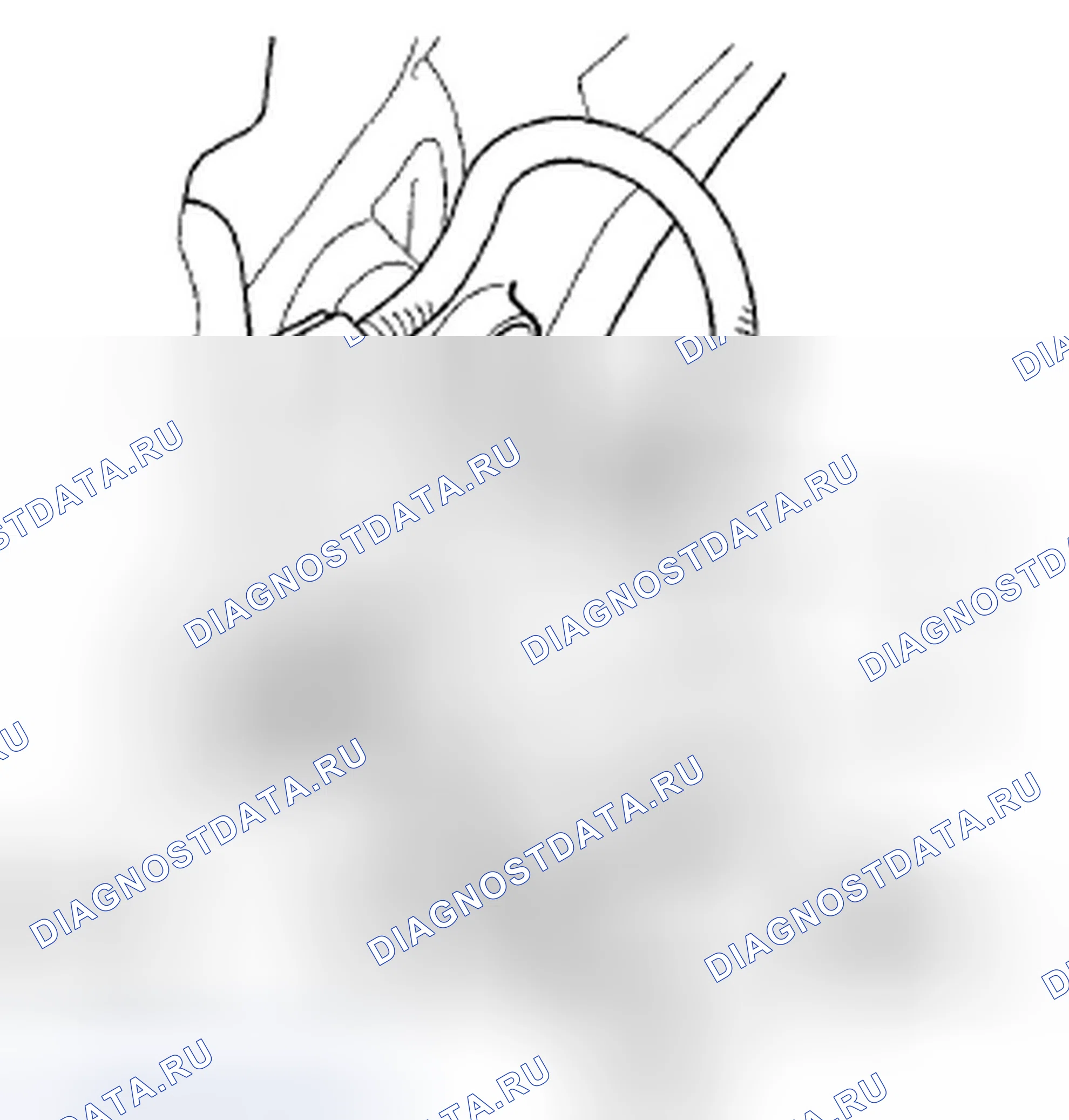 Рис. 868: M / T. Honda Accord VIII