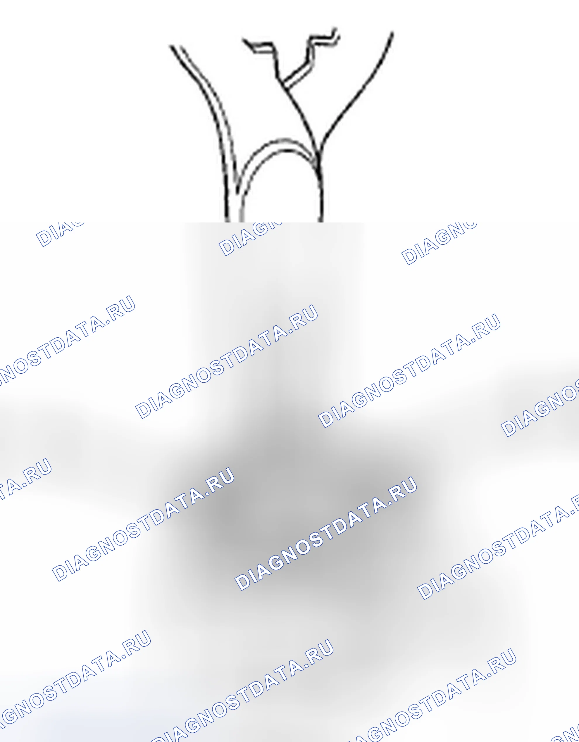 Рис. 137: Замена насоса CVTF. Honda Insight ZE2