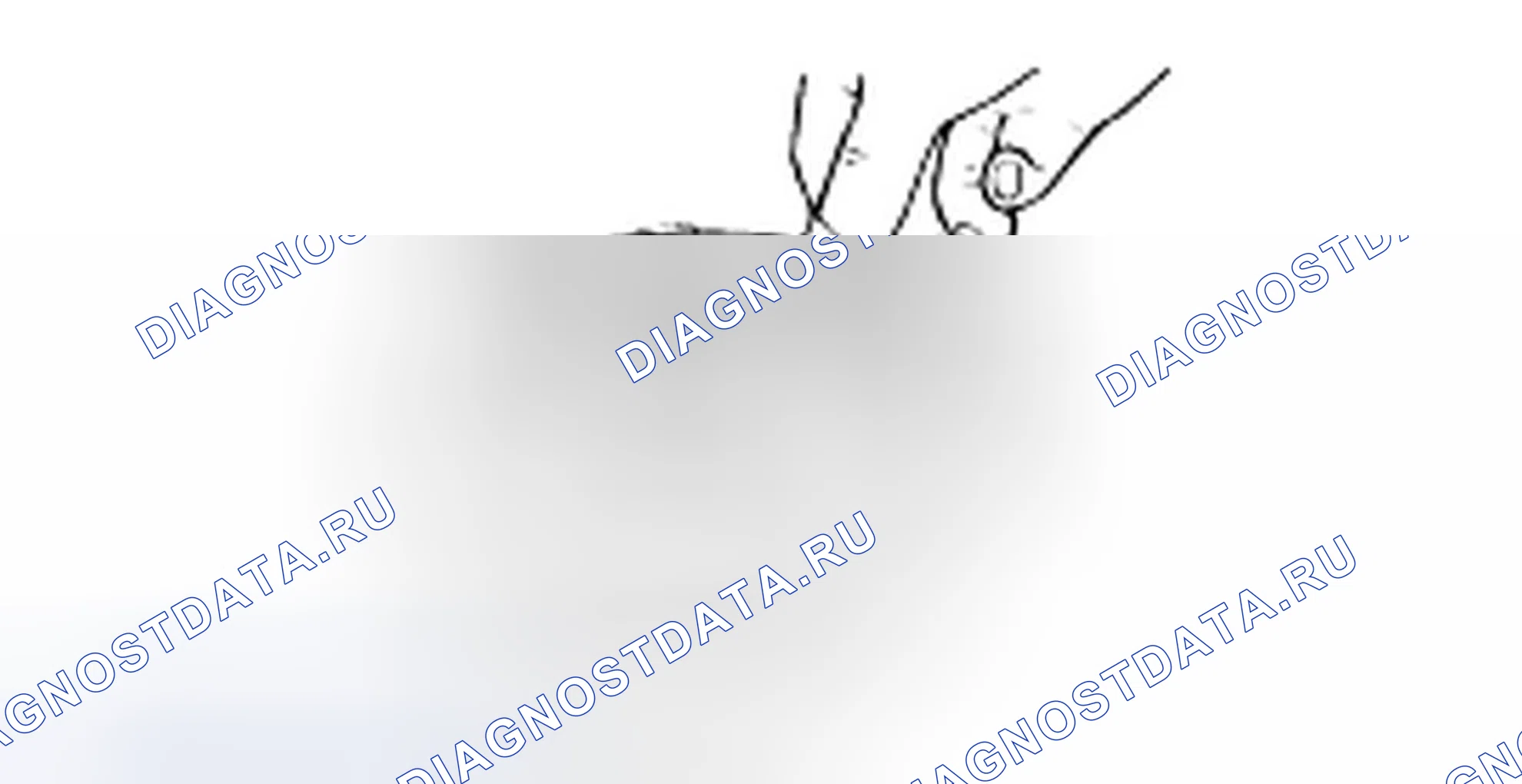 Сборка муфты реверса и овердрайва. Hyundai H-1 A1