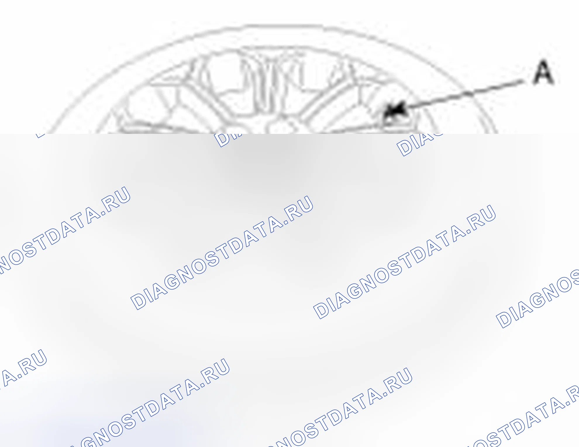 Рис. 28: Снятие шины. Geely SC7 I